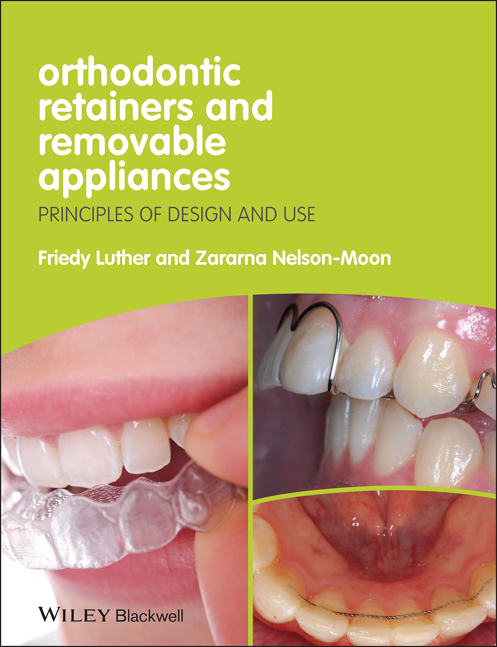 Orthodontic Retainers and Removable Appliances: Principles of Design and Use Medicine