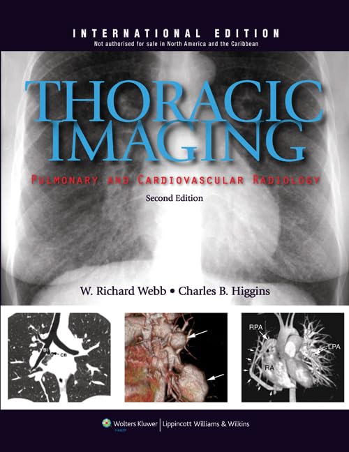 Thoracic Imaging: Pulmonary and Cardiovascular Radiology Medicine