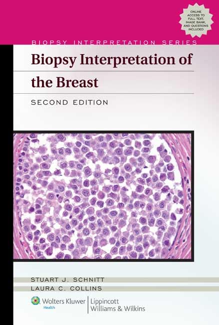 Biopsy Interpretation of the Breast (Biopsy Interpretation Series) Medicine