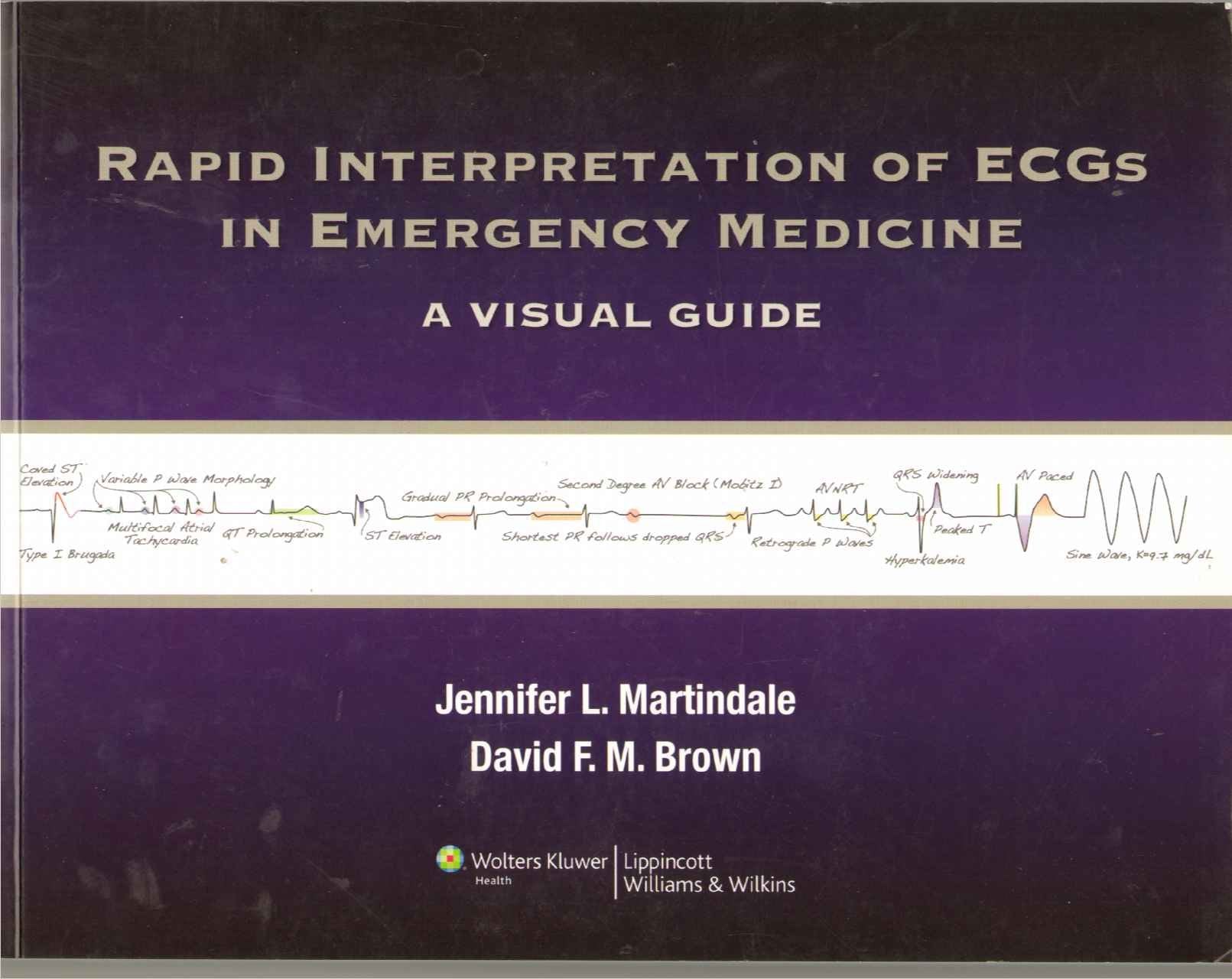 Rapid Interpretation of ECGs in Emergency Medicine: A Visual Guide Medicine