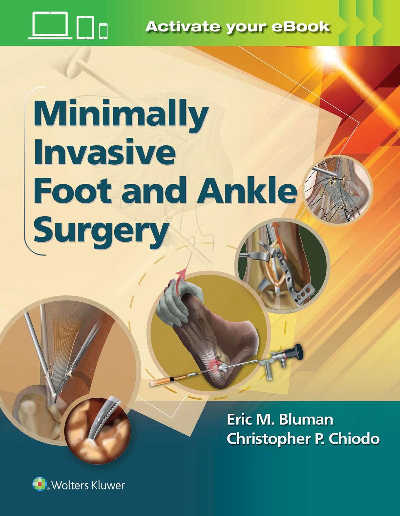 Minimally Invasive Foot and Ankle Surgery book