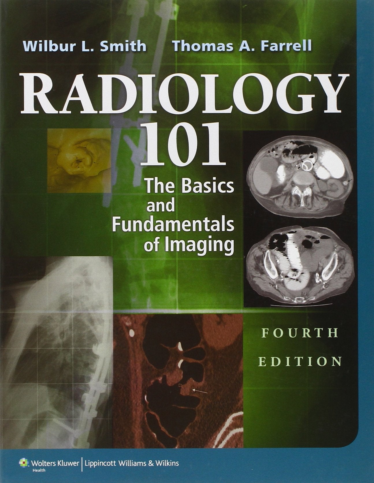 Radiology 101: The Basics and Fundamentals of Imaging Medicine