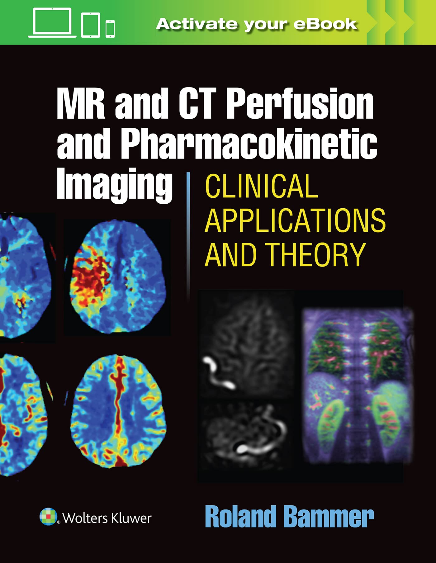 Mr and Ct Perfusion and Pharmacokinetic Imaging: Clinical Applications and Theoretical Principles book