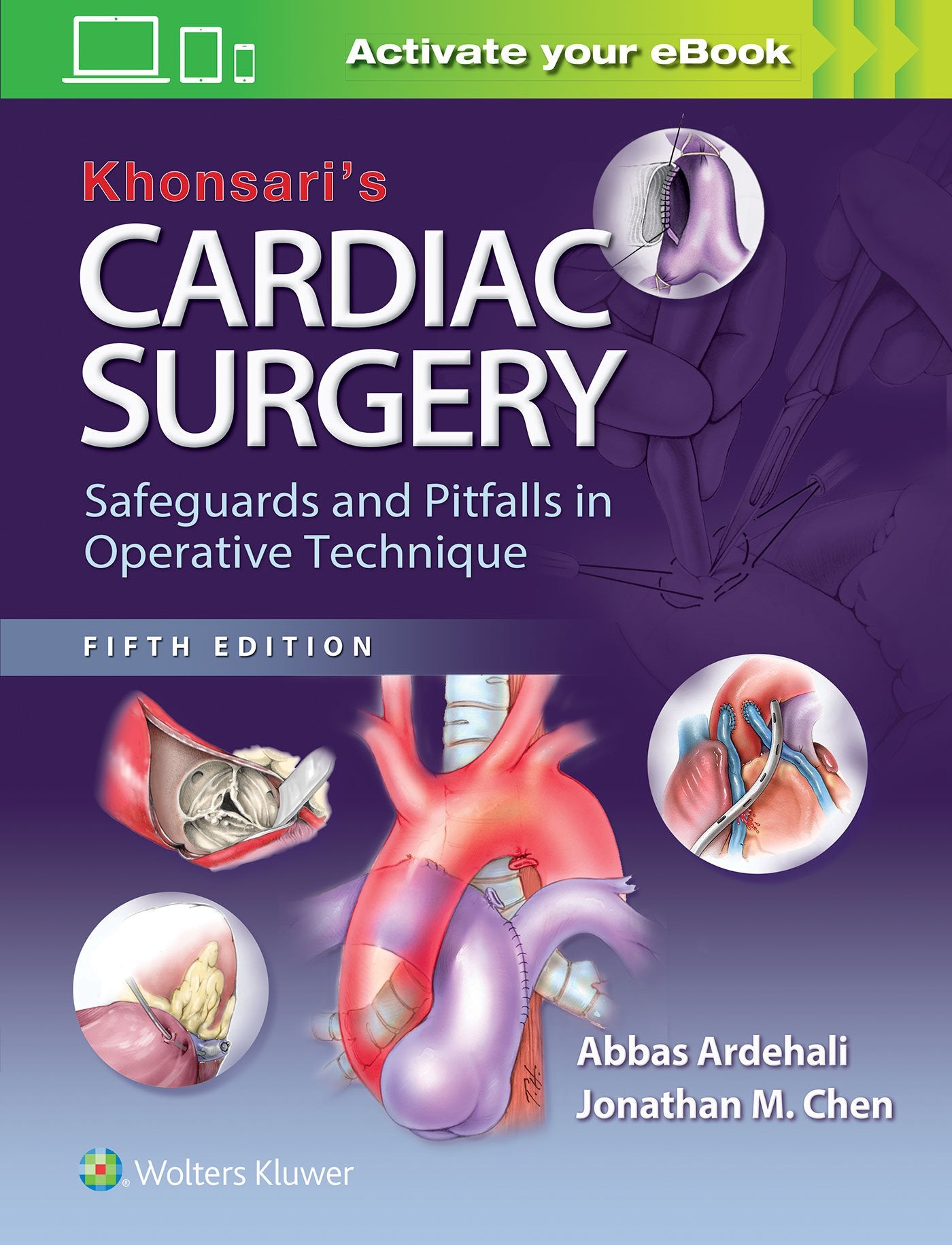 Khonsari's Cardiac Surgery: Safeguards and Pitfalls in Operative Technique, 5 Vols. Medicine