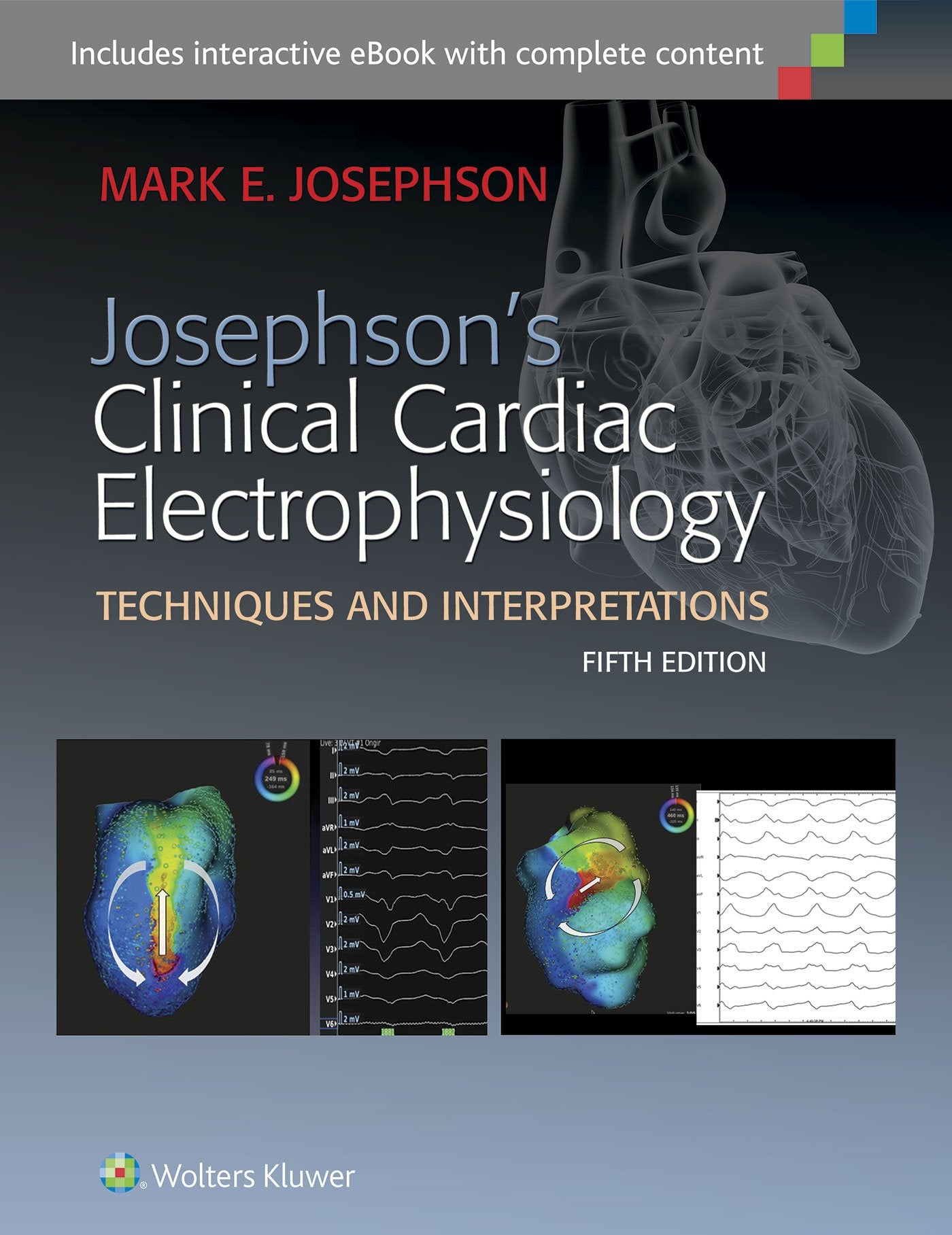 Josephson's Clinical Cardiac Electrophysiology Medicine