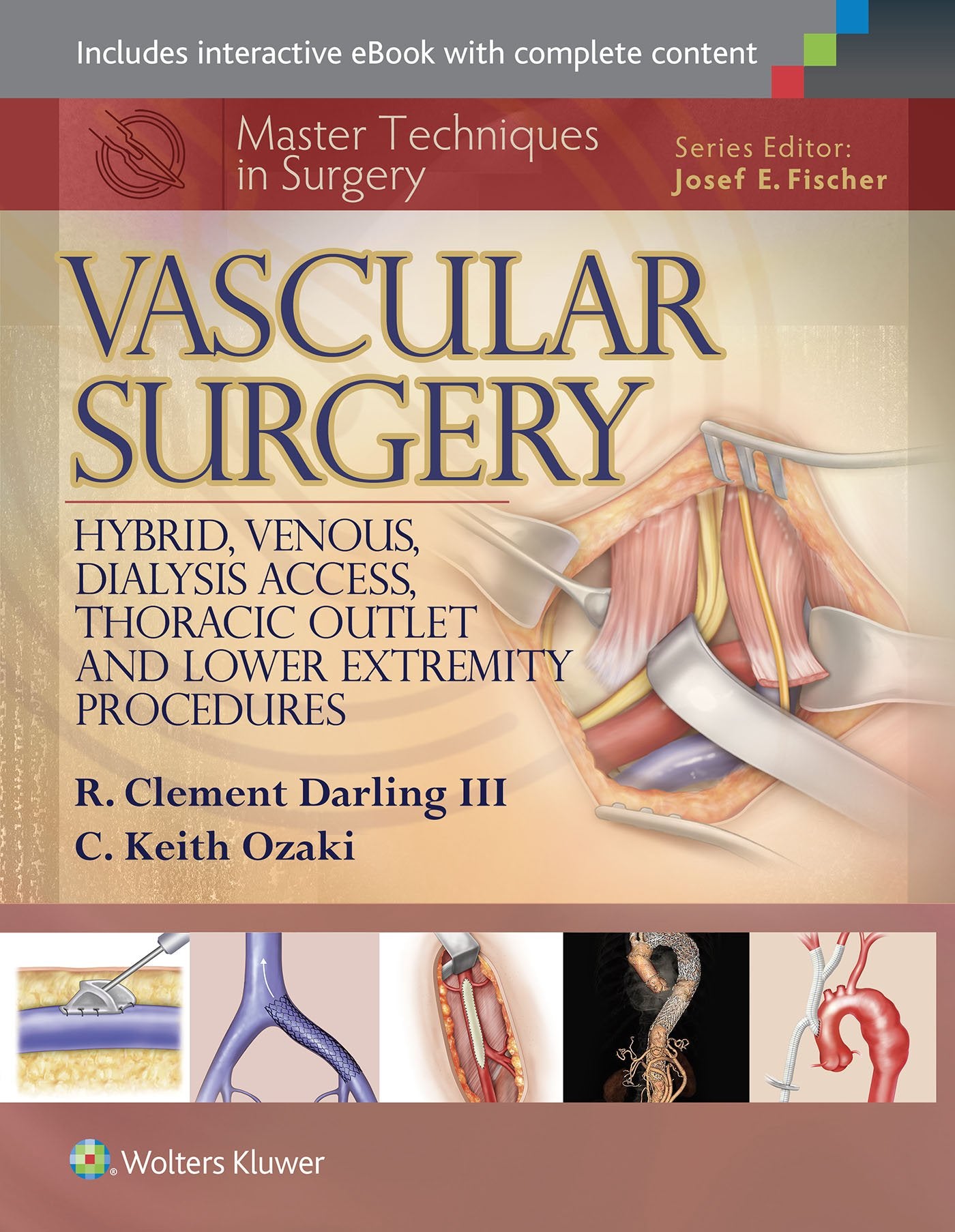 Master Techniques in Surgery: Vascular Surgery: Hybrid, Venous, Dialysis Access, Thoracic Outlet, and Lower Extremeity Procedures Medicine