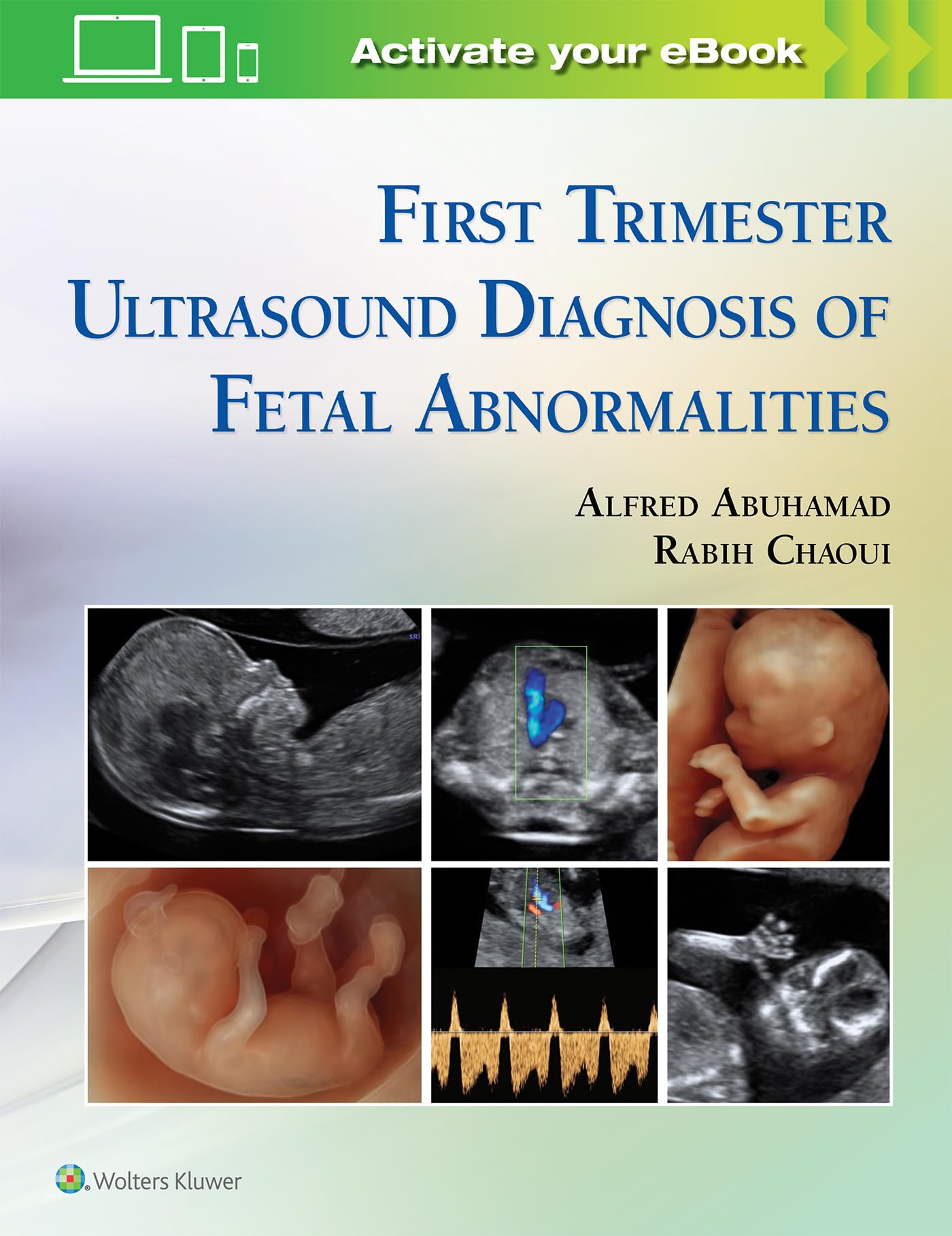 First Trimester Ultrasound Diagnosis of Fetal Abnormalities Medicine