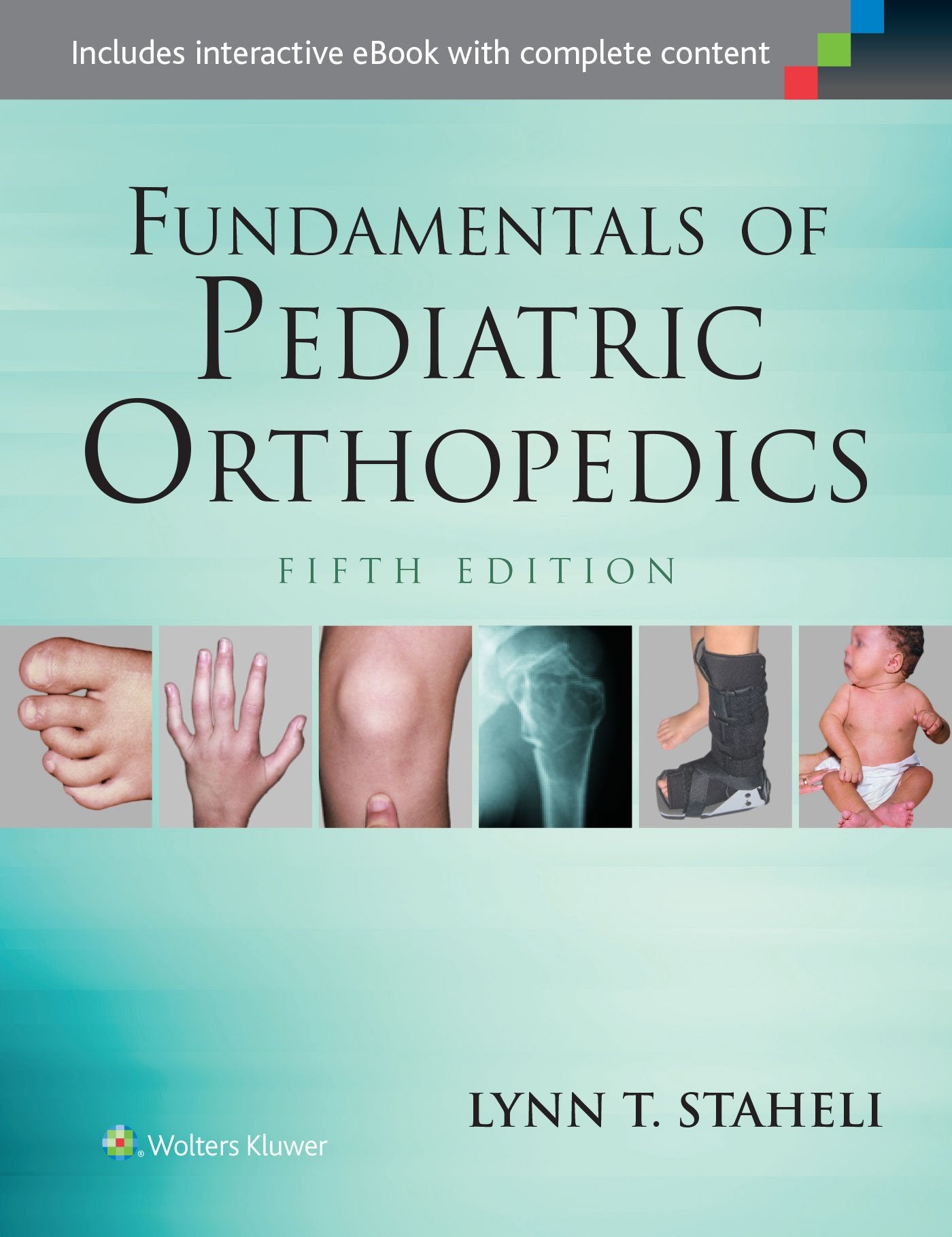 Fundamentals of Pediatric Orthopedics (Staheli, Fundamentals of Pediatric Orthopedics) Medicine
