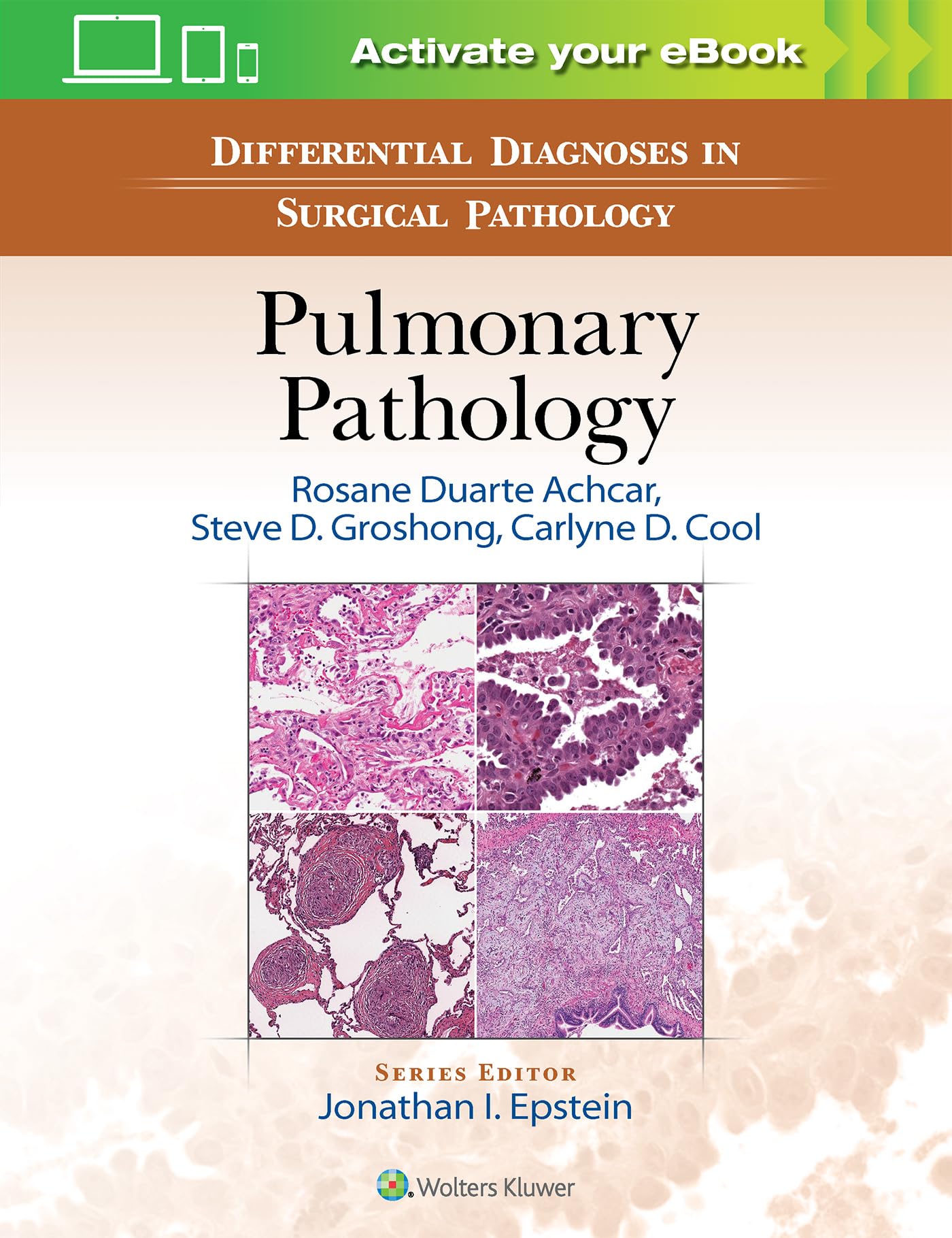 Differential Diagnosis in Surgical Pathology: Pulmonary Pathology book