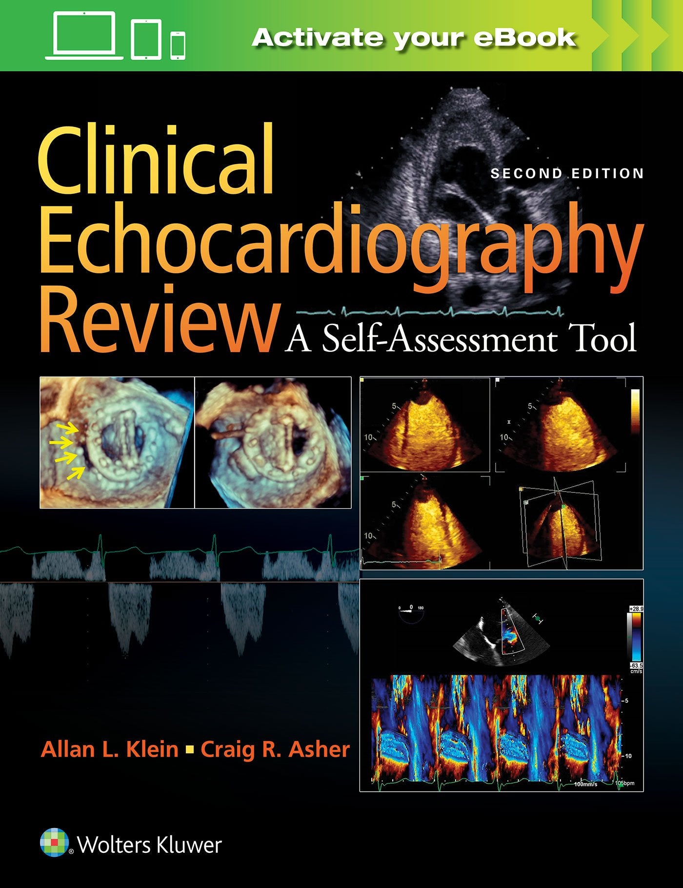Clinical Echocardiography Review: A Self-assessment Tool Medicine