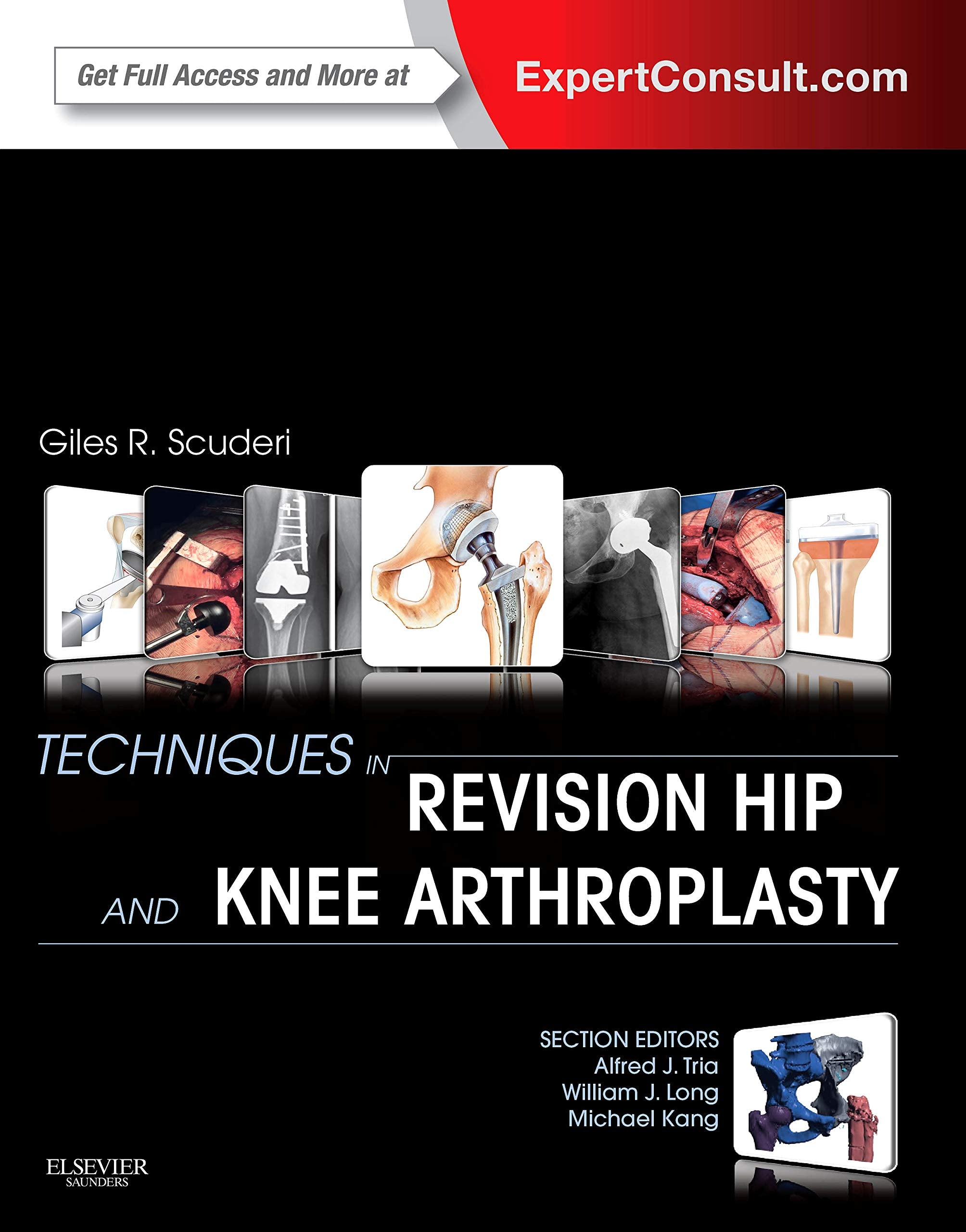 Techniques in Revision Hip and Knee Arthroplasty: Expert Consult: Online and Print Medicine