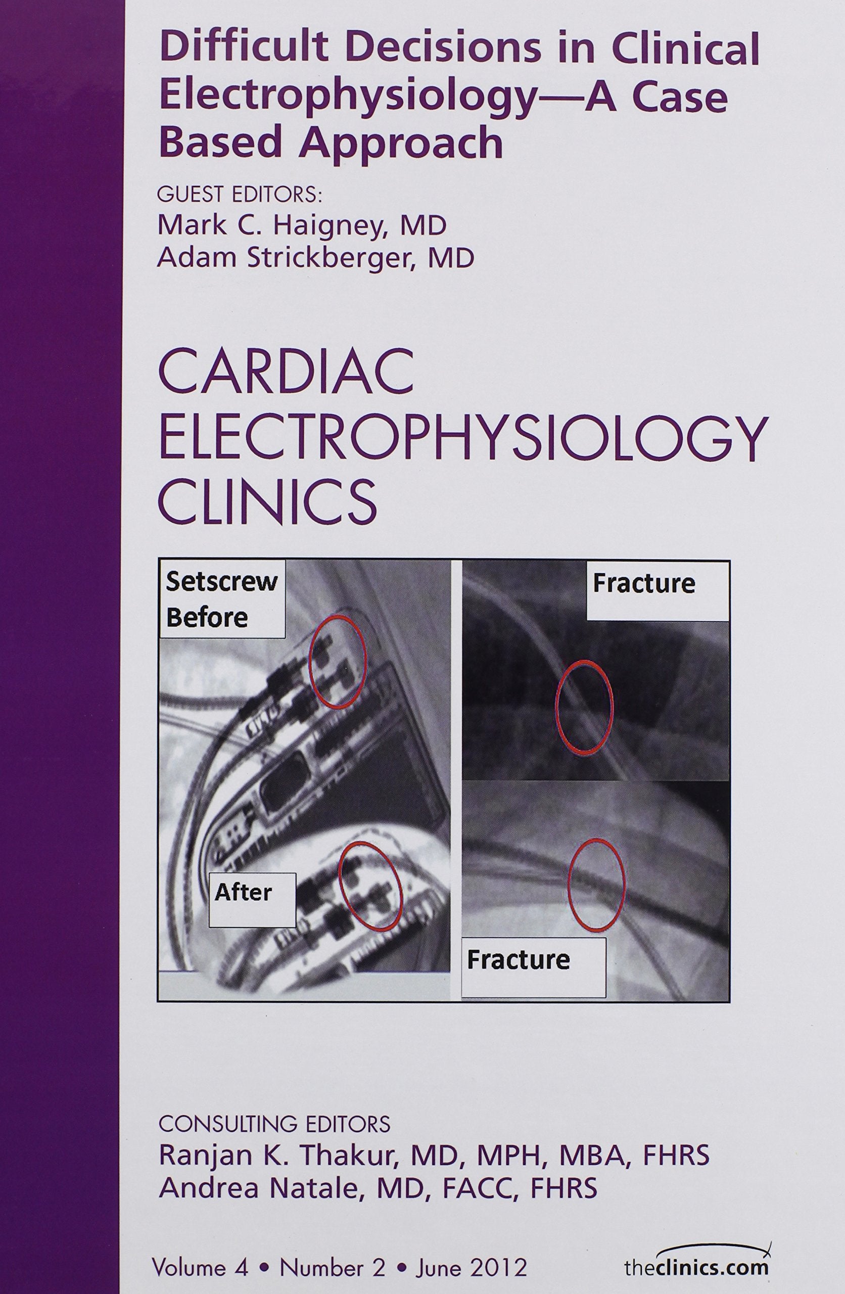 Difficult Decisions in Clinical Electrophysiology - A Case Based Approach, An Issue of Cardiac Electrophysiology Clinics (Volume 4-2) (The Clinics: Internal Medicine, Volume 4-2) Medicine