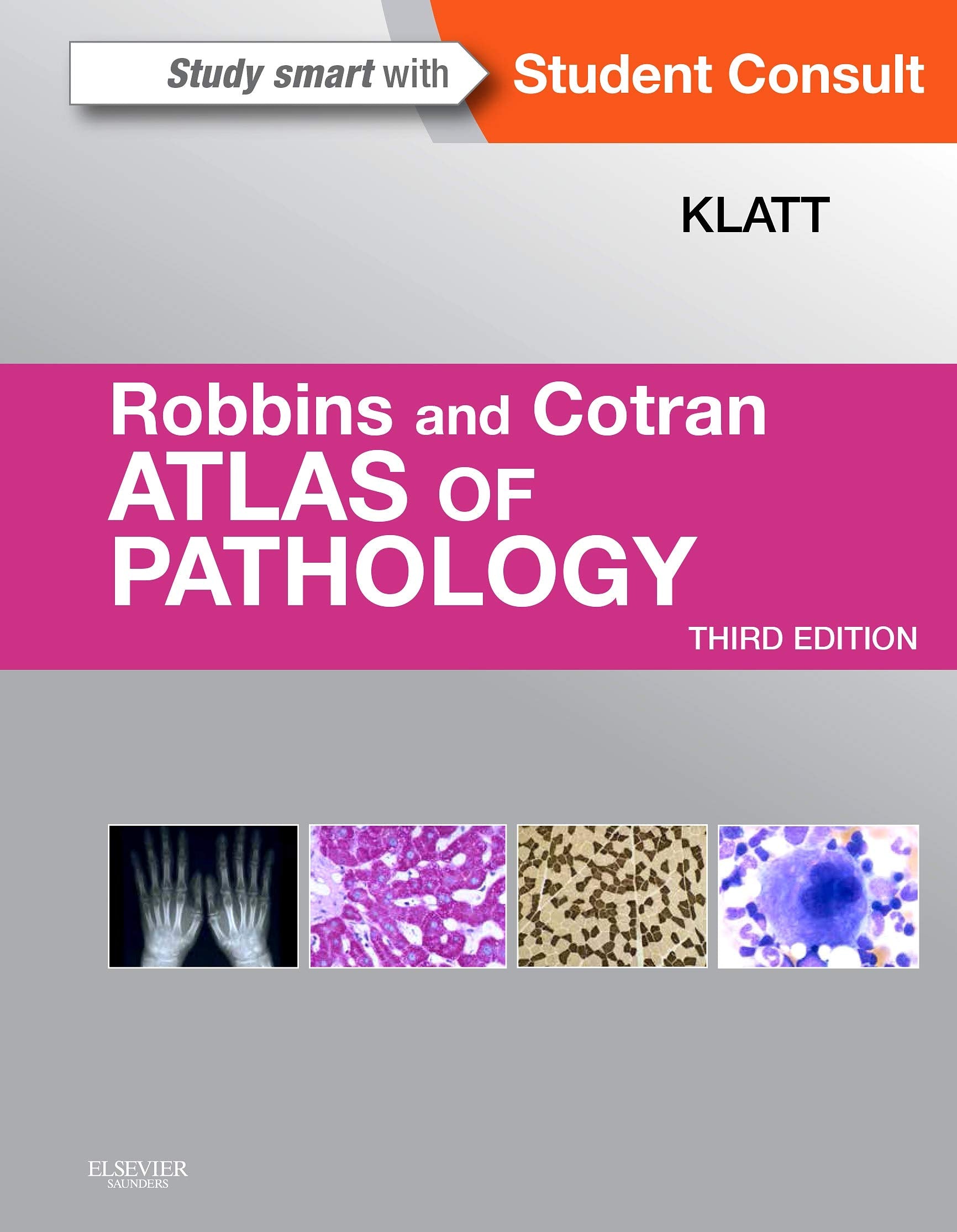 Robbins and Cotran Atlas of Pathology Medicine