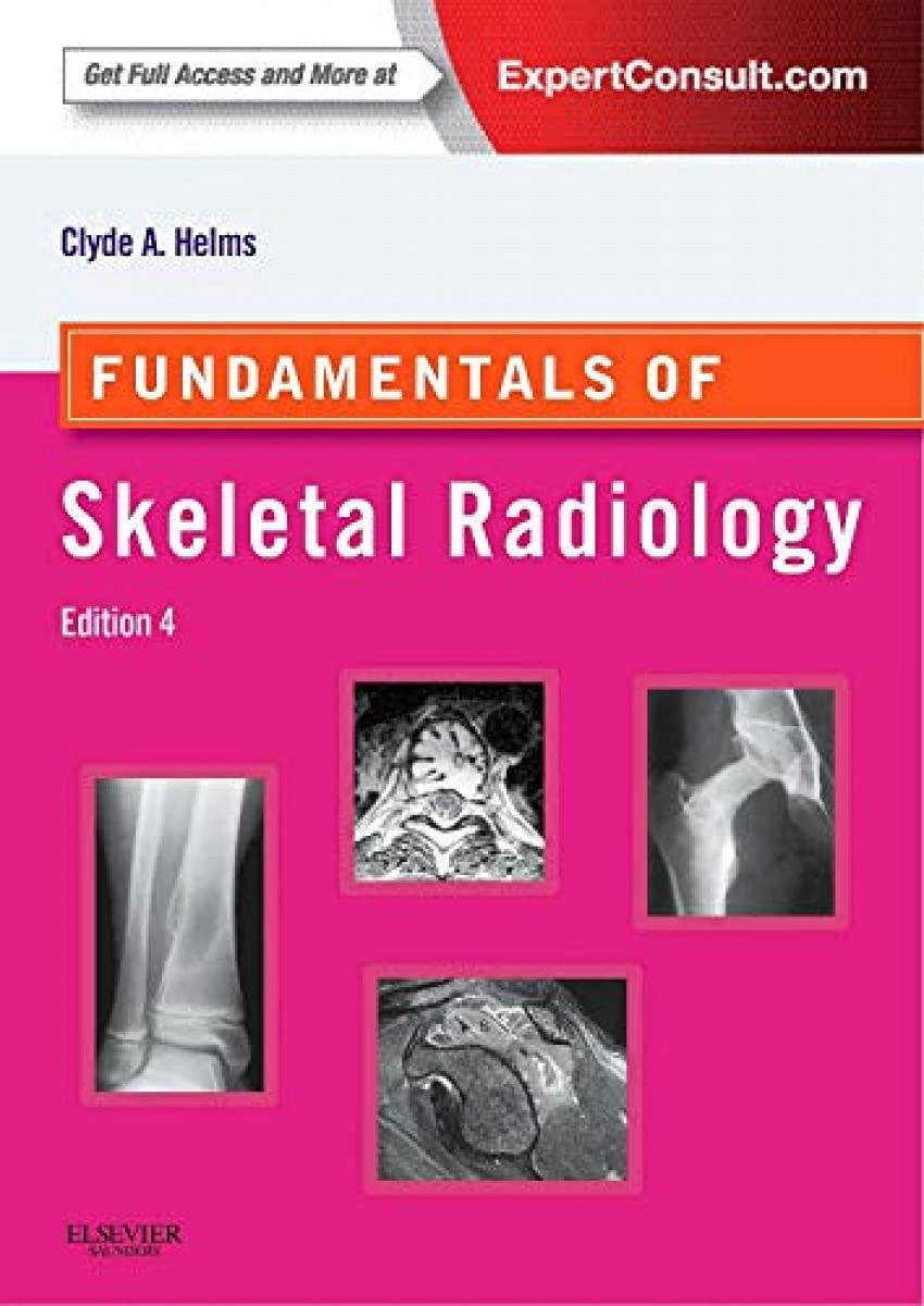 Fundamentals of Skeletal Radiology book