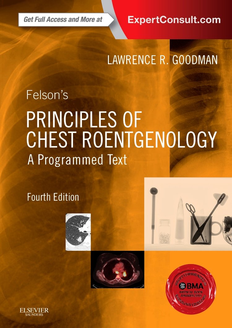 Felson's Principles of Chest Roentgenology, A Programmed Text Medicine