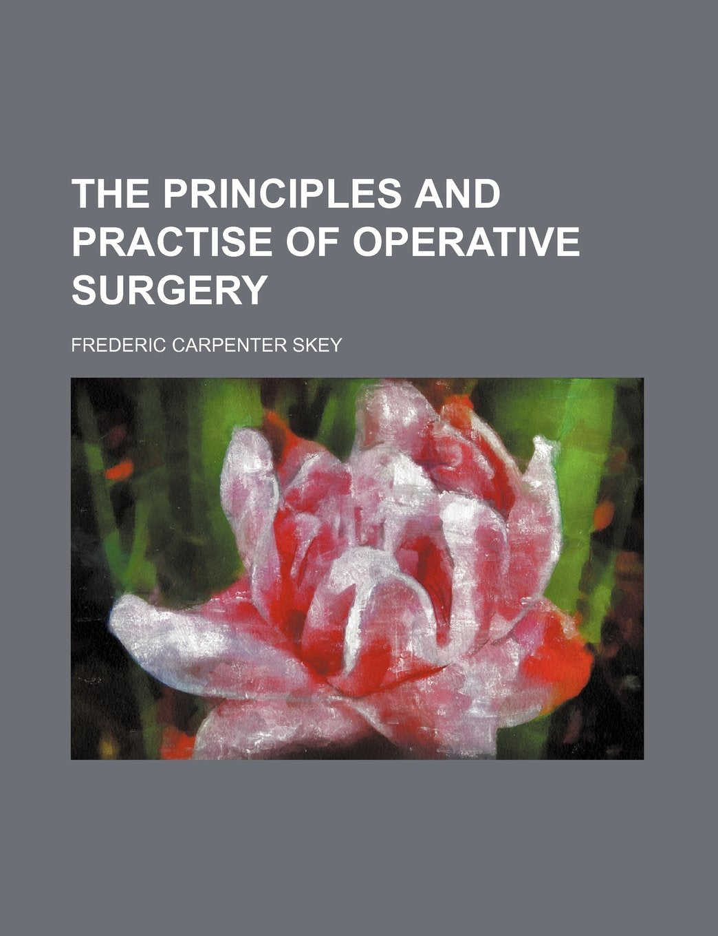 The Principles and Practise of Operative Surgery Books