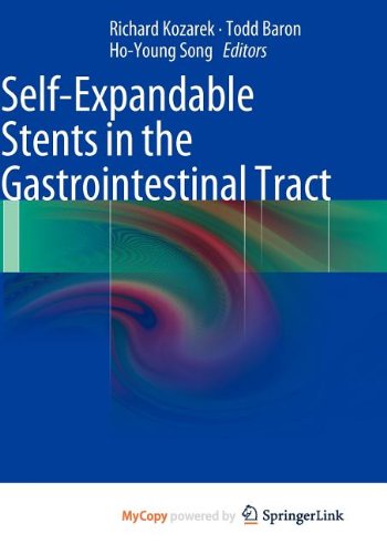 Self-Expandable Stents in the Gastrointestinal Tract Medicine