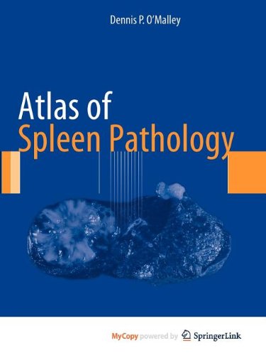 Atlas of Spleen Pathology Medicine