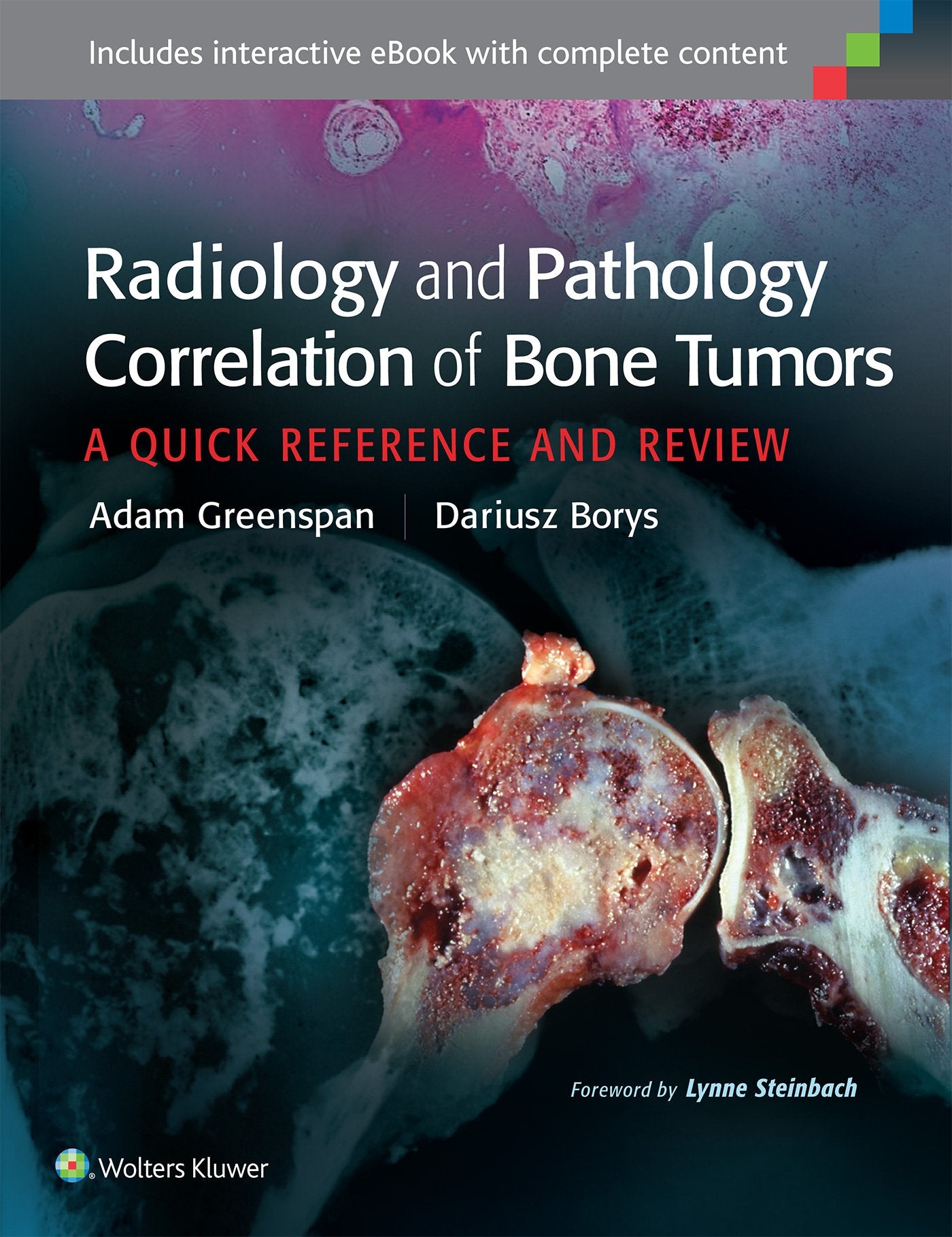 Radiology and Pathology Correlation of Bone Tumors: A Quick Reference and Review book