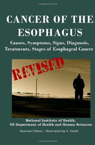 Cancer Of The Esophagus: Causes, Symptoms, Signs, Diagnosis, Treatments, Stages of Esophageal Cancer Health, Nutrition & Fitness