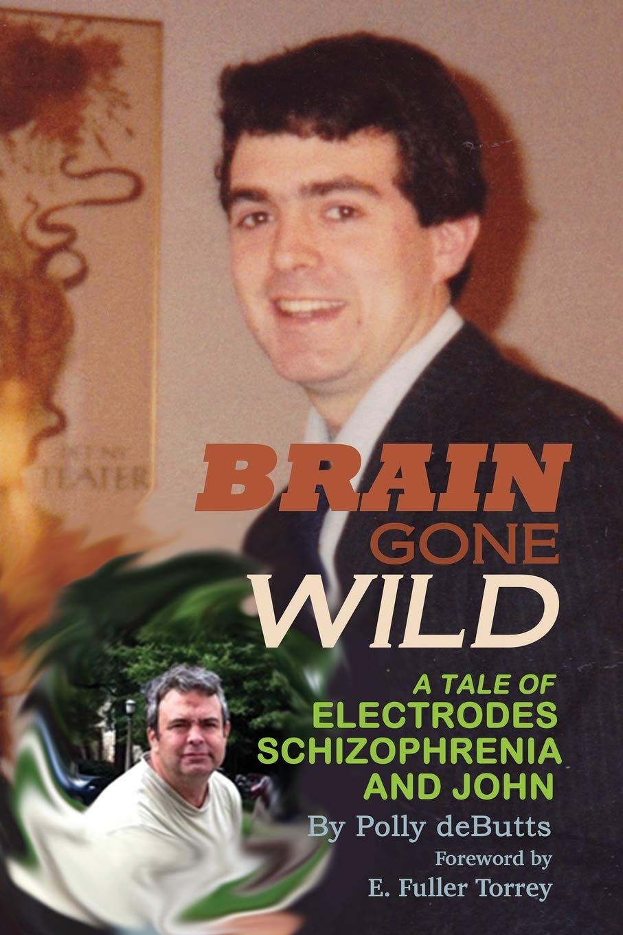 Brain Gone Wild: A Tale of Electrodes, Schizophrenia, and John Medicine