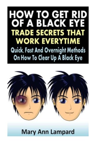 How To Get Rid Of A Black Eye : Trade Secrets That Work Everytime: Quick, Fast And Overnight Methods On How To Clear Up A Black Eye Health, Nutrition & Fitness