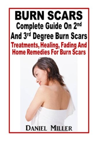 Burn Scars : Complete Guide On 2nd And 3rd Degree Burn Scars: Treatments, Healing, Fading And Home Remedies For Burn Scars Health, Nutrition & Fitness