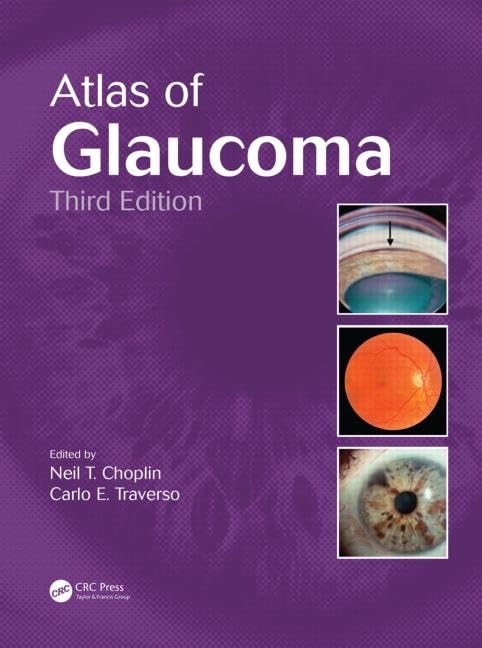 Atlas of Glaucoma Medicine