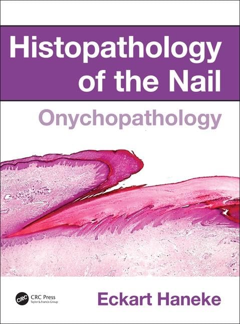 Histopathology of the Nail: Onychopathology Medicine
