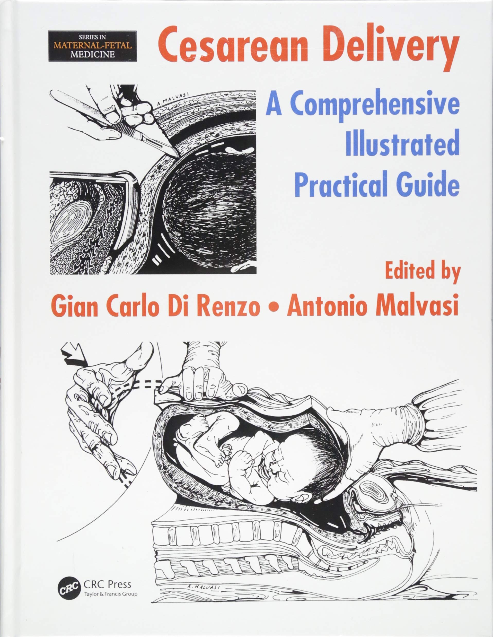 Cesarean Delivery: A Comprehensive Illustrated Practical Guide (Maternal-Fetal Medicine) Medicine