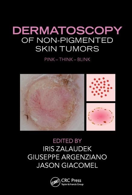 Dermatoscopy of Non-Pigmented Skin Tumors: Pink - Think - Blink Medicine