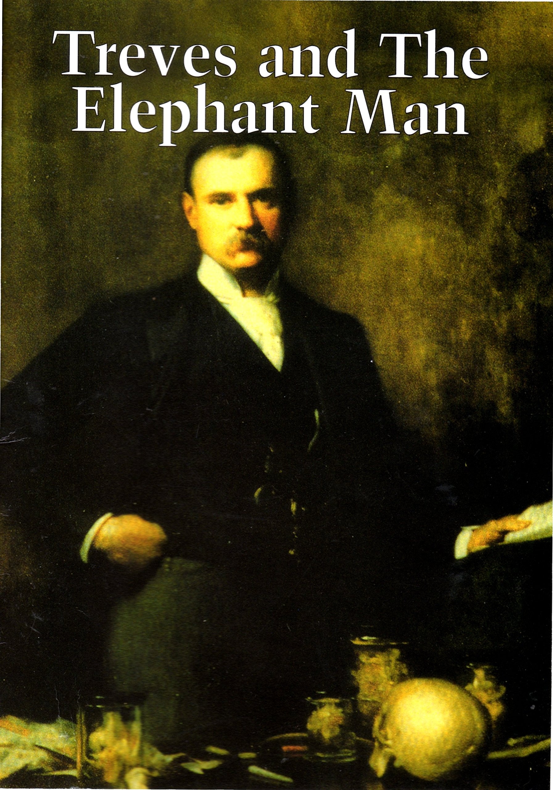 The Elephant Man And Other Reminiscences Memories