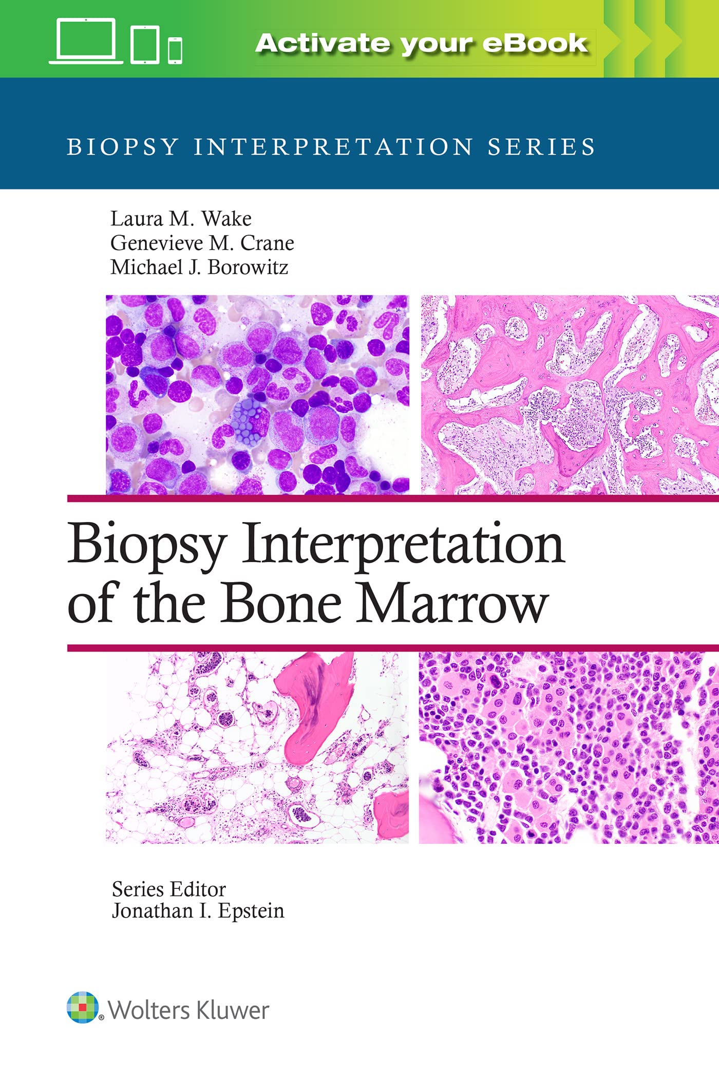 Biopsy Interpretation of the Bone Marrow: Print + eBook with Multimedia Medicine
