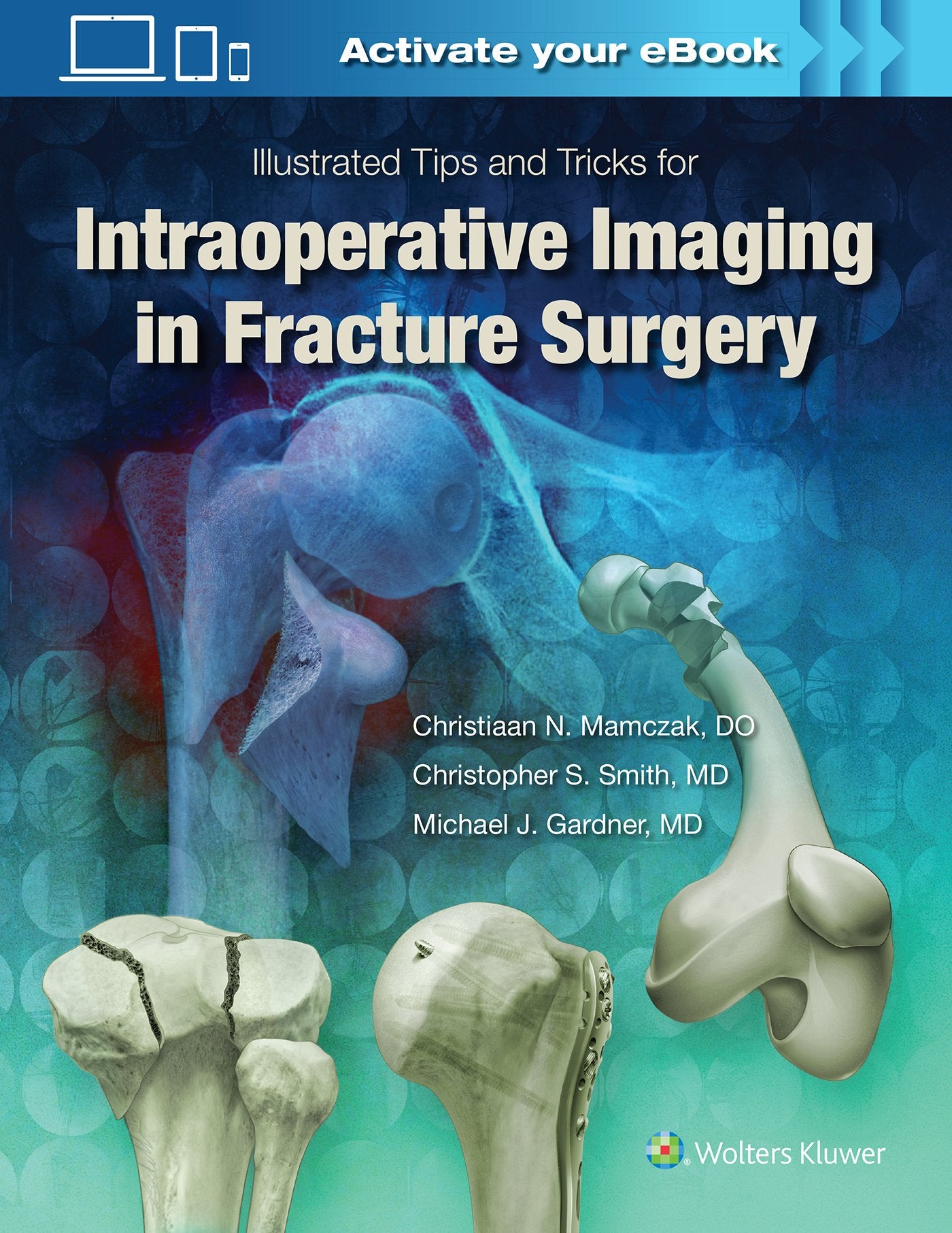 Illustrated Tips and Tricks for Intraoperative Imaging in Fracture Surgery Medicine