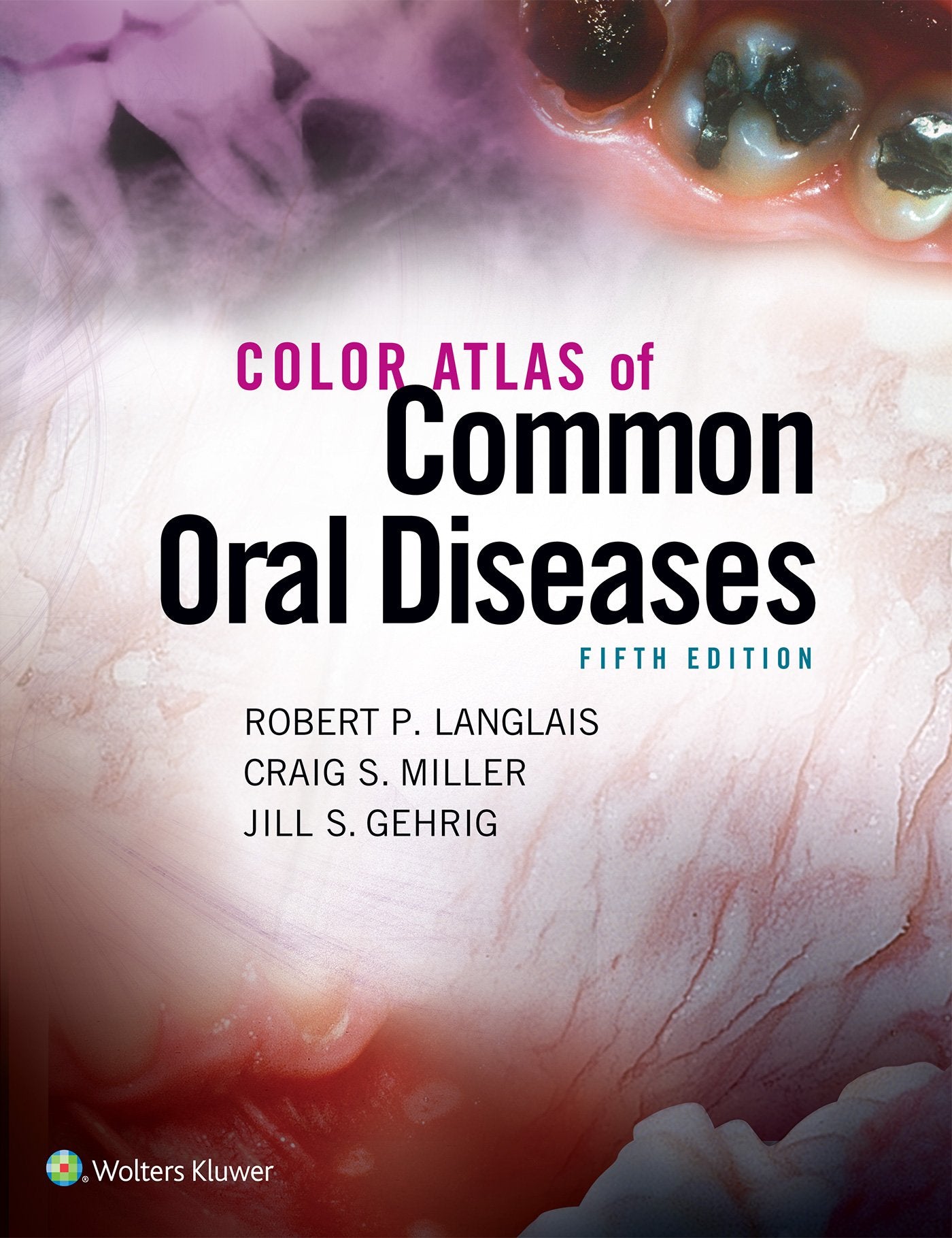 Color Atlas of Common Oral Diseases Medicine
