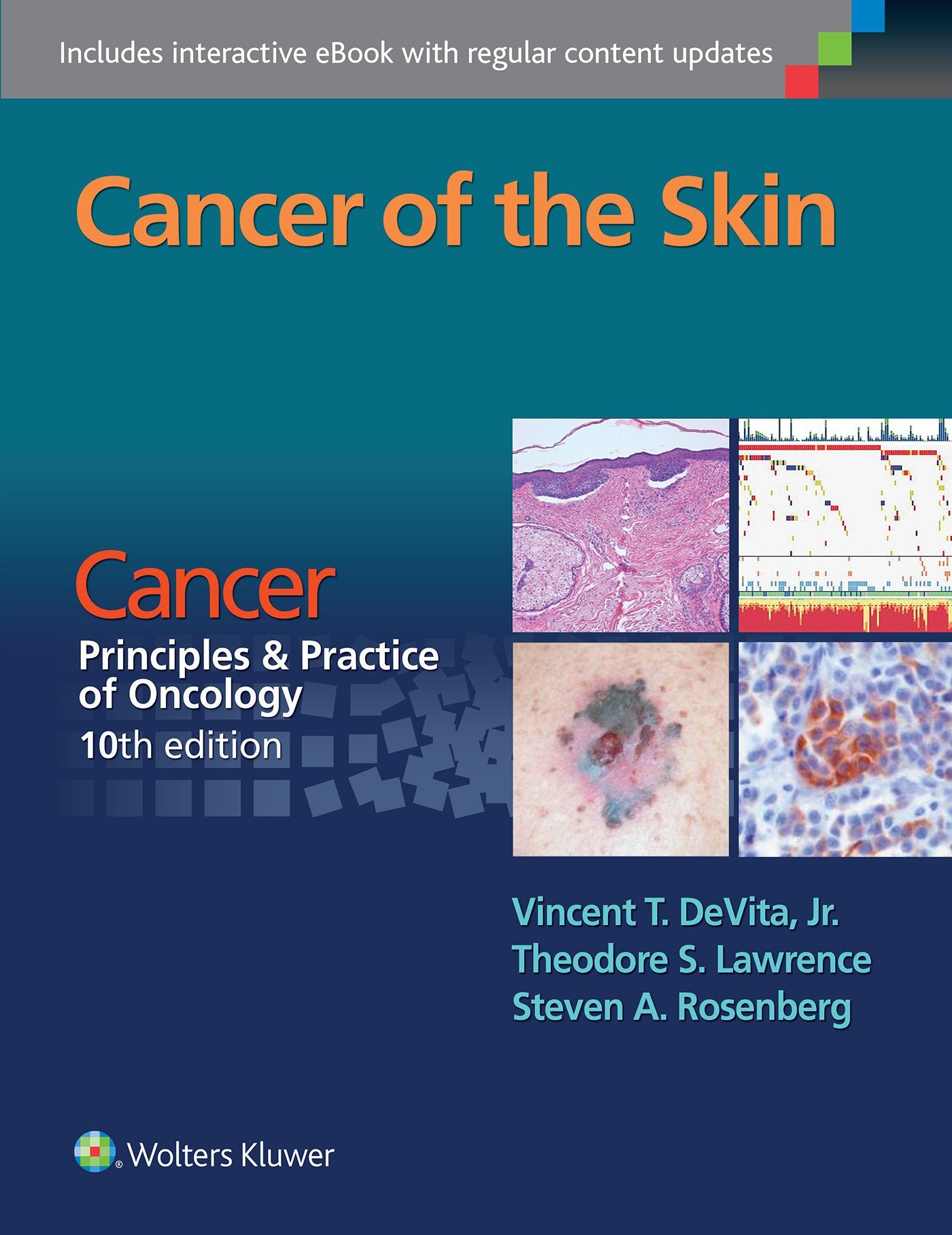 Cancer of the Skin: From Cancer: Principles & Practice of Oncology 10th Edition book