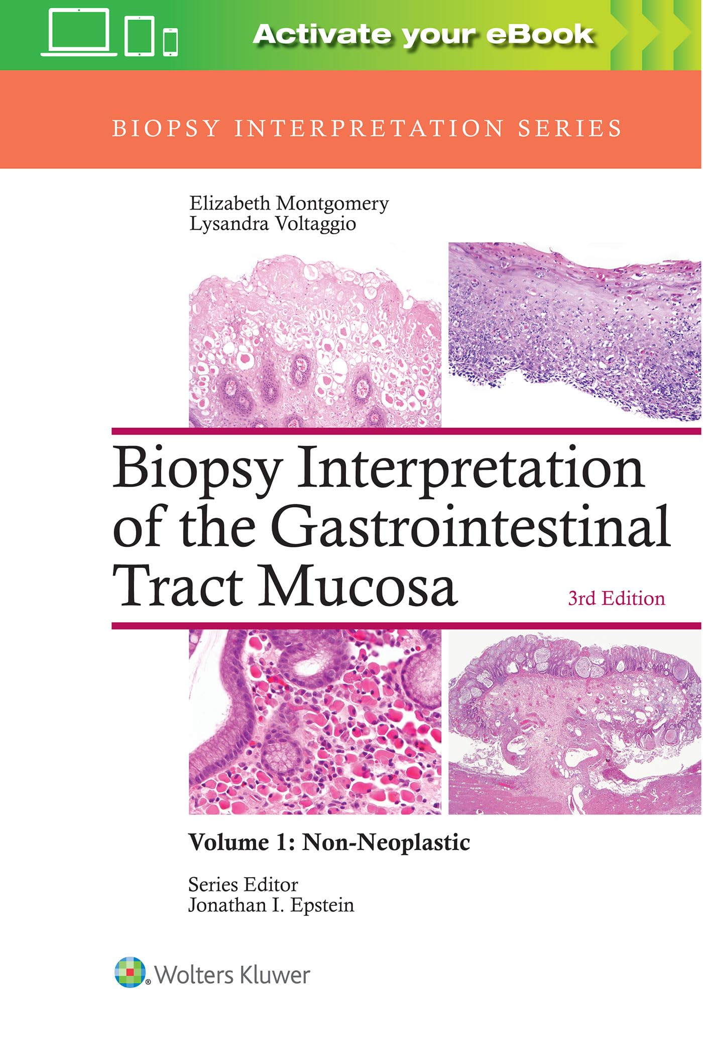 Biopsy Interpretation of the Gastrointestinal Tract Mucosa: Non-Neoplastic (1) Medicine