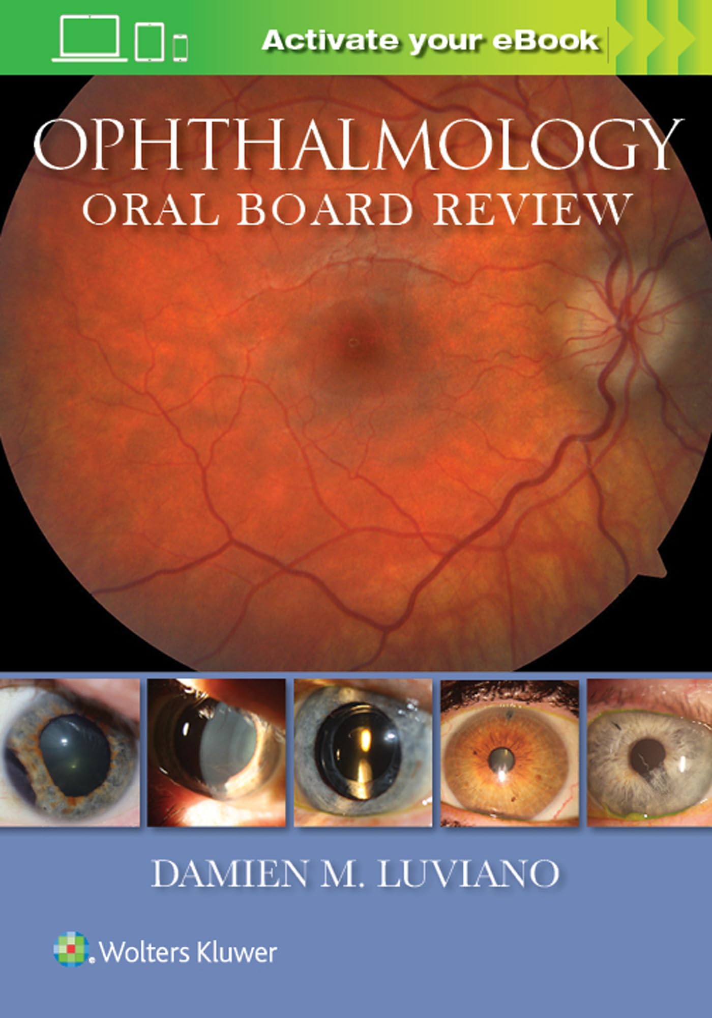 Ophthalmology Oral Board Review Medicine