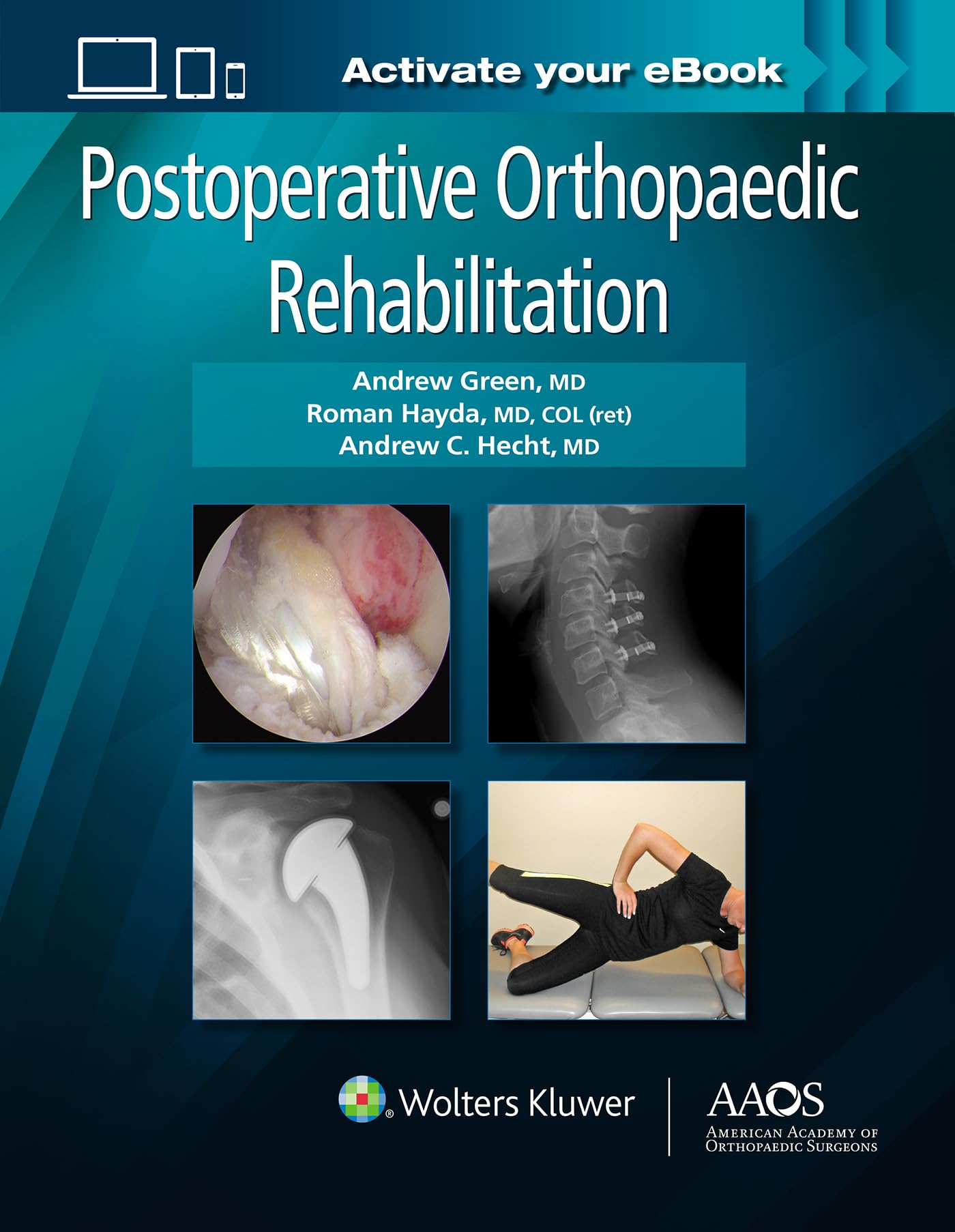 Postoperative Orthopaedic Rehabilitation (AAOS - American Academy of Orthopaedic Surgeons) Medicine
