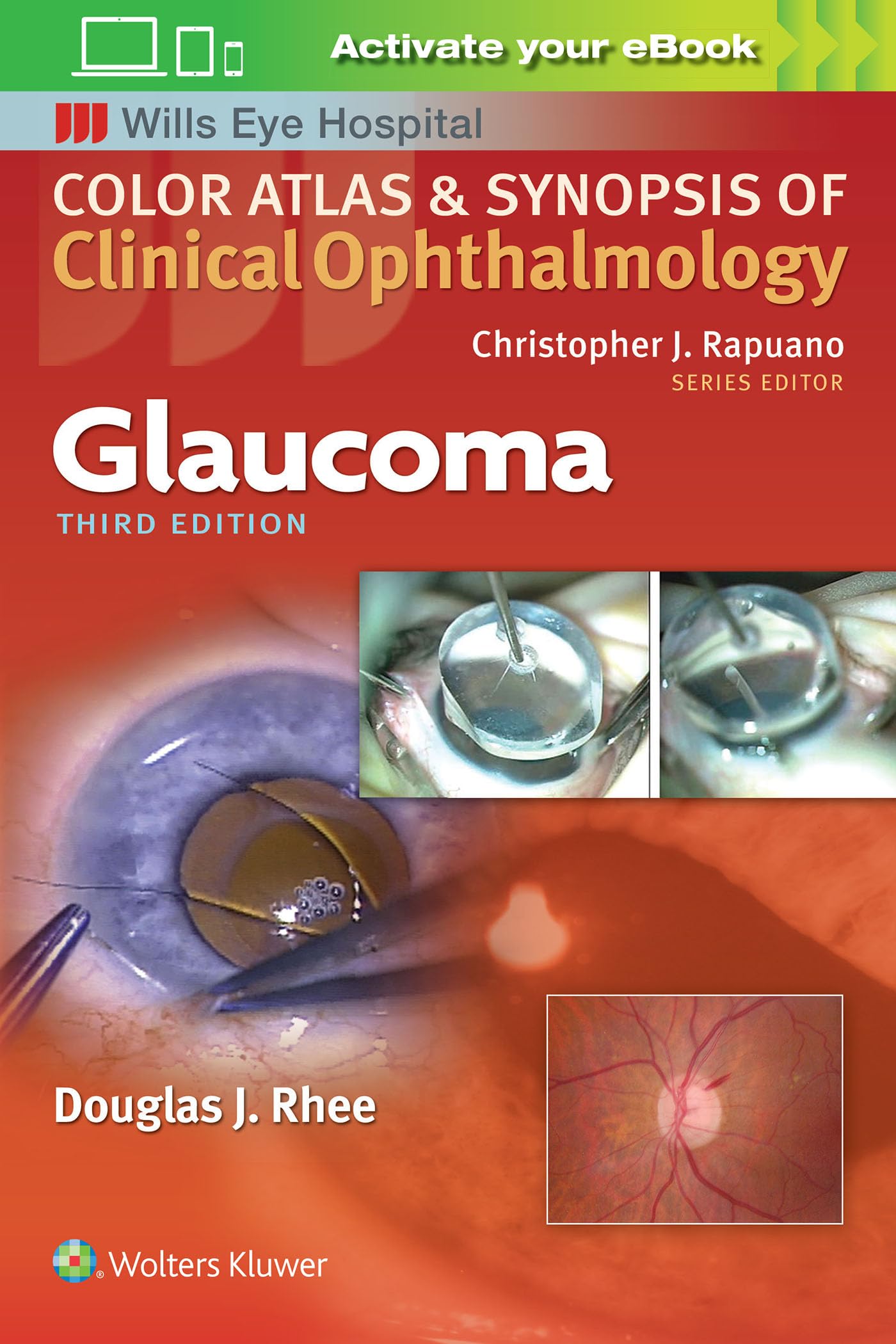 Glaucoma (Color Atlas and Synopsis of Clinical Ophthalmology) Medicine