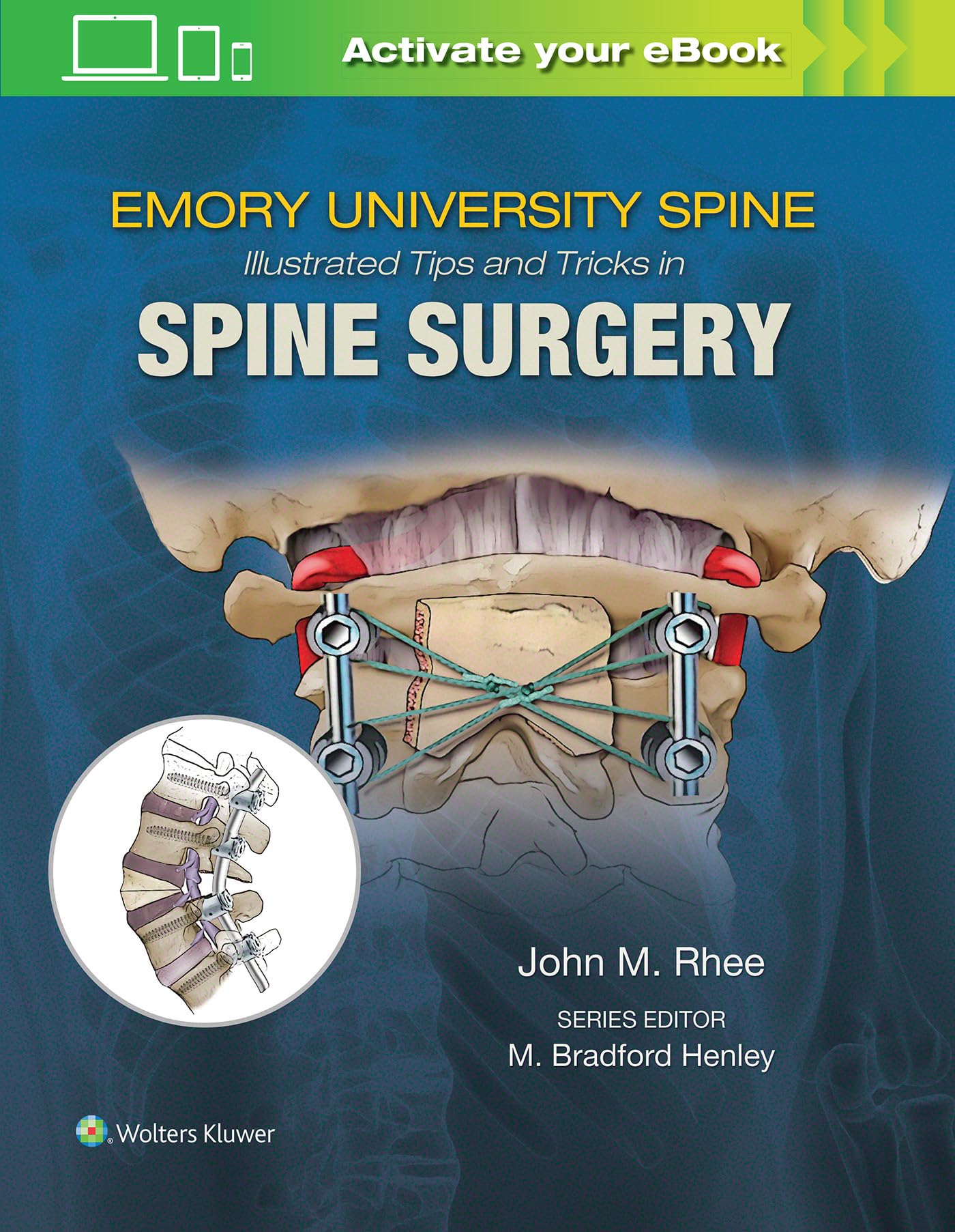Emory University Spine: Illustrated Tips and Tricks in Spine Surgery Medicine