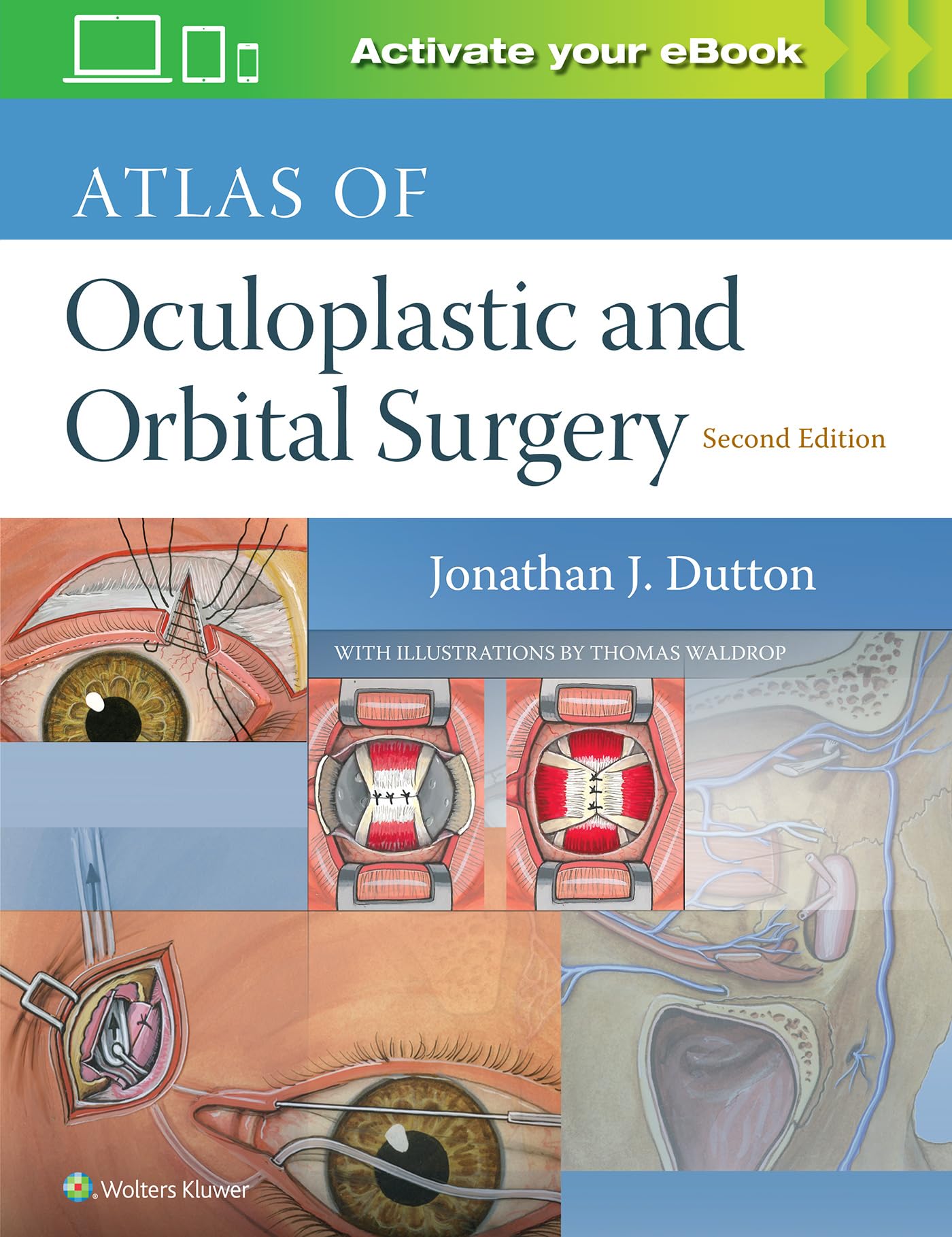 Atlas of Oculoplastic and Orbital Surgery Medicine
