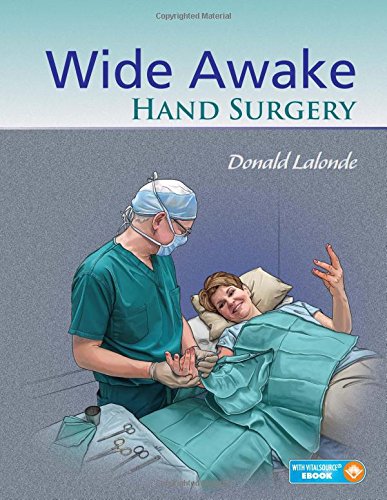 Wide Awake Hand Surgery Medicine