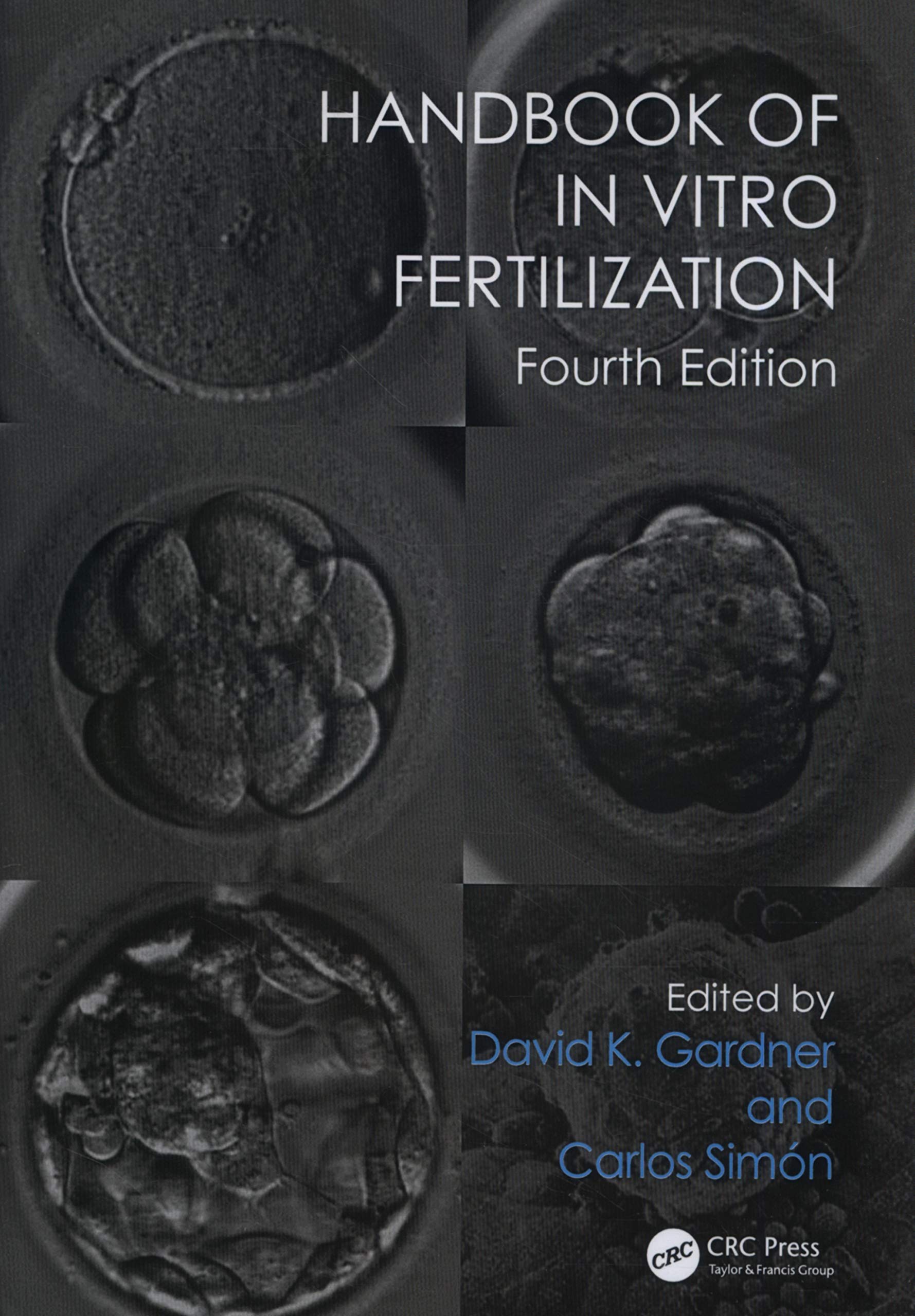 Handbook of In Vitro Fertilization Medicine