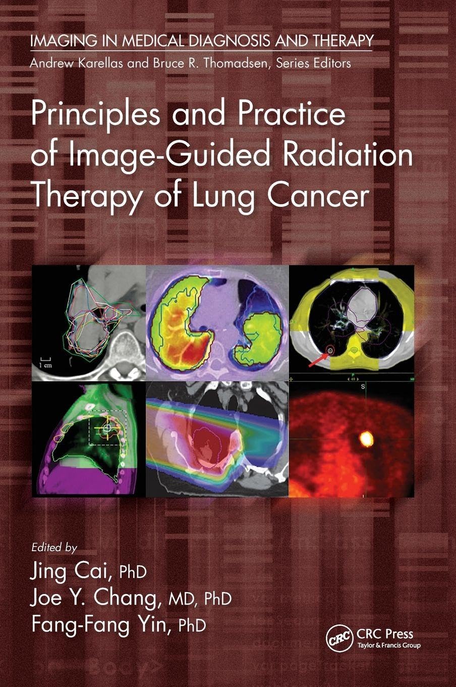 Principles and Practice of Image-Guided Radiation Therapy of Lung Cancer Medicine