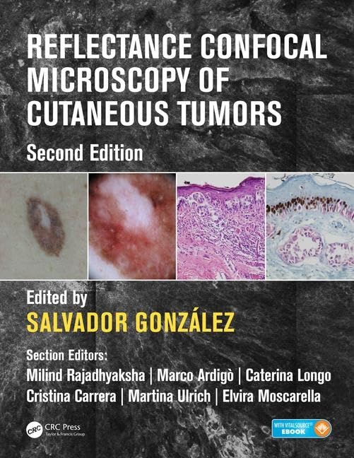 Reflectance Confocal Microscopy of Cutaneous Tumors Medicine