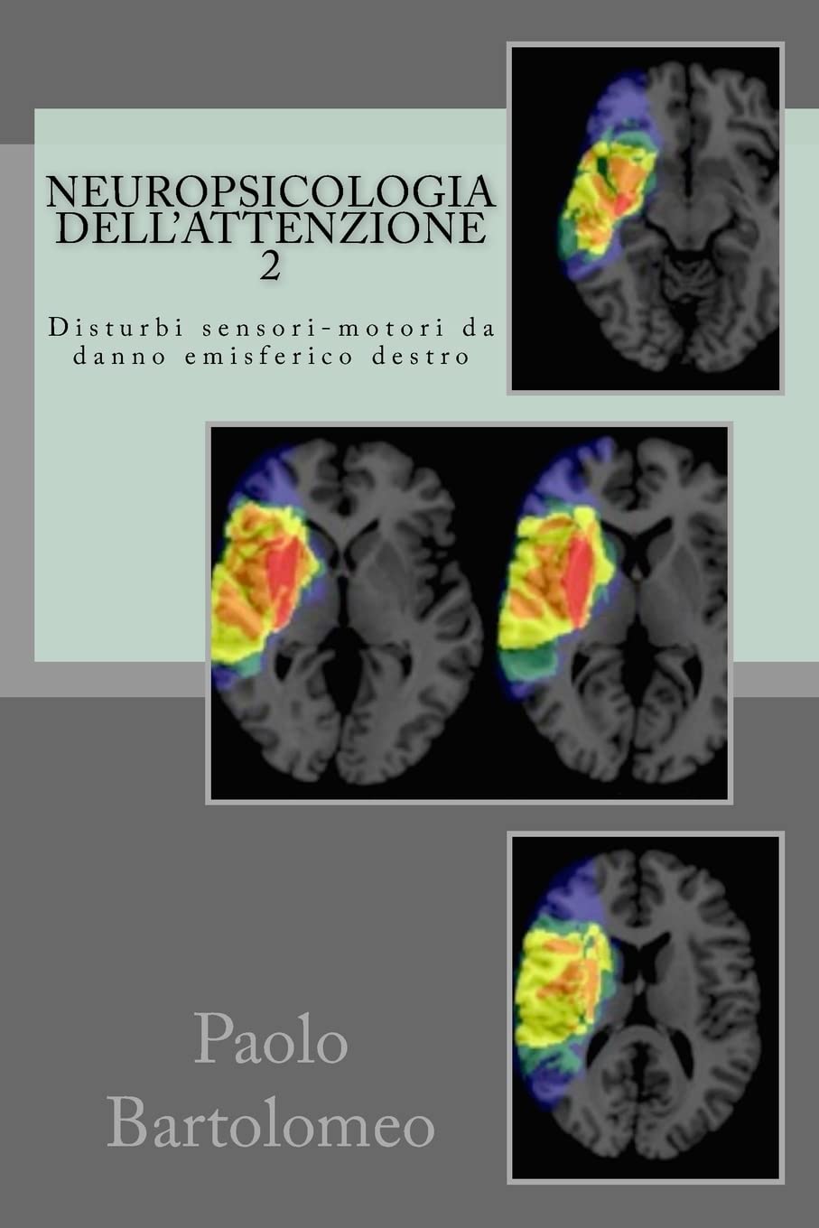 Neuropsicologia dell'attenzione 2: Disturbi sensori-motori da danno emisferico destro Medicine