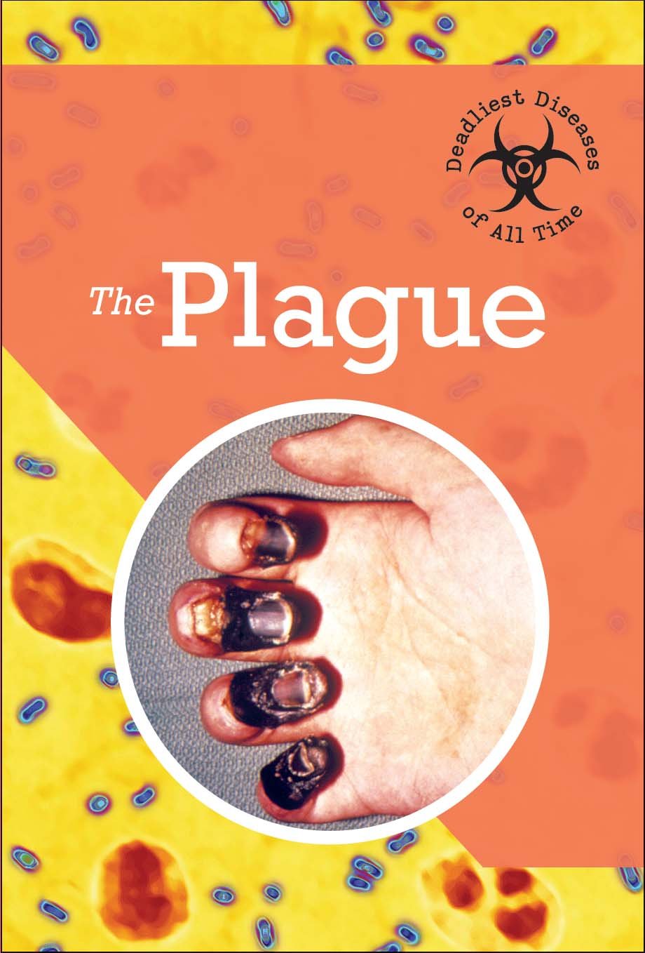 The Plague (Deadliest Diseases of All Time) Books