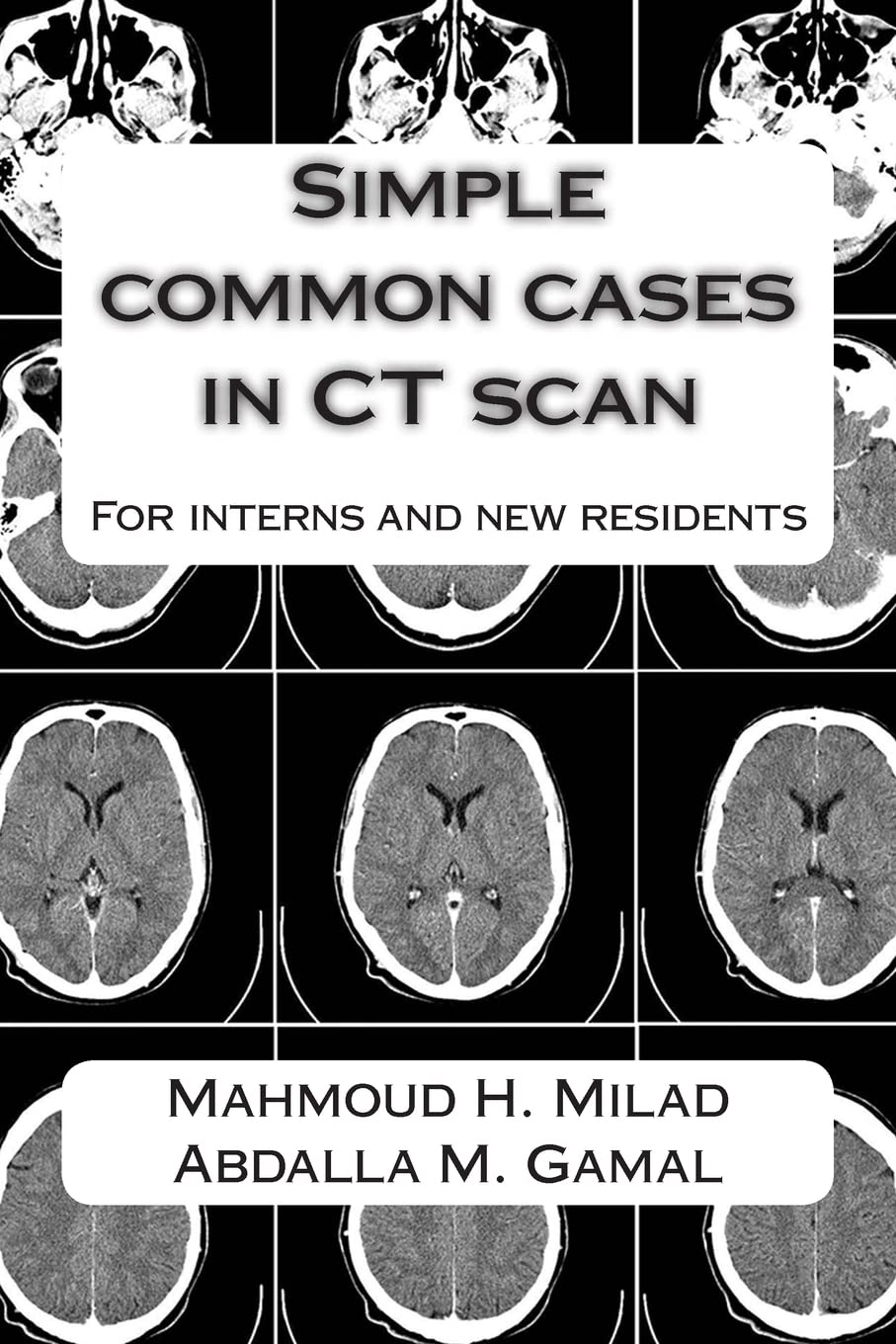 Simple common cases in CT scan: For interns and new residents Medicine
