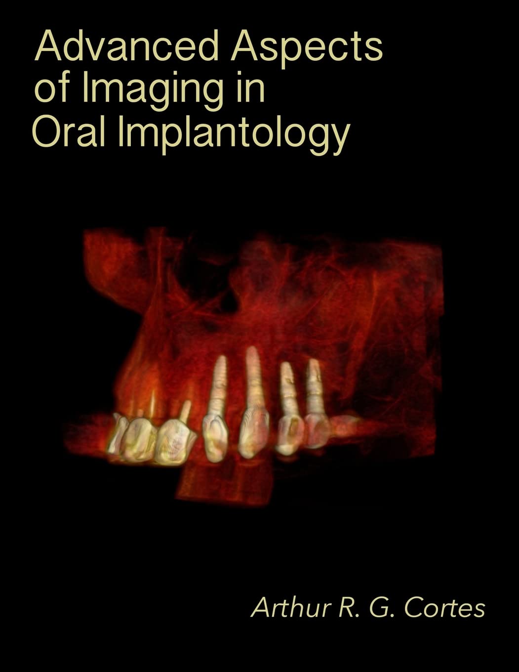 Advanced Aspects of Imaging in Oral Implantology Medicine